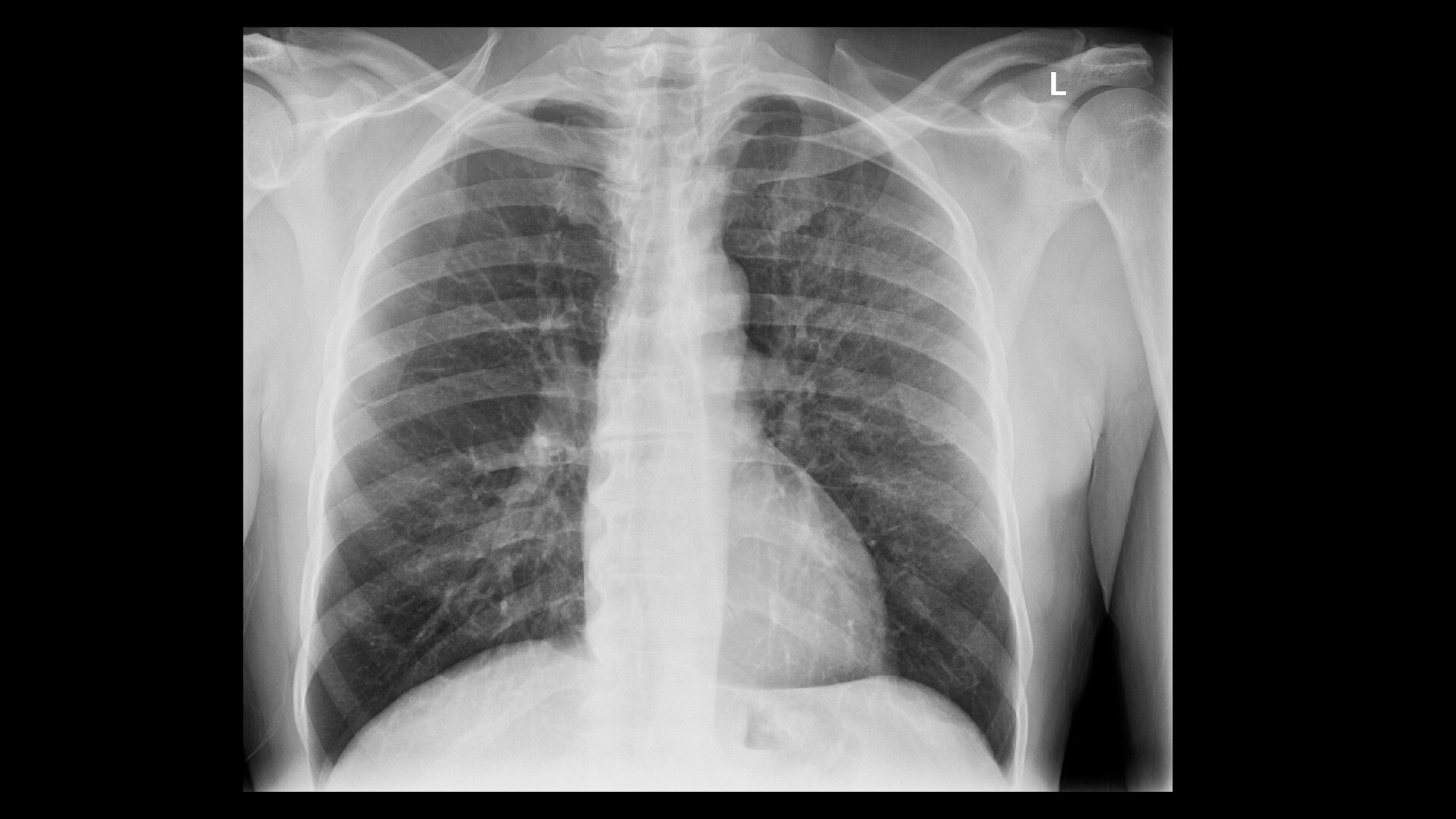 Product Media Carousel Image