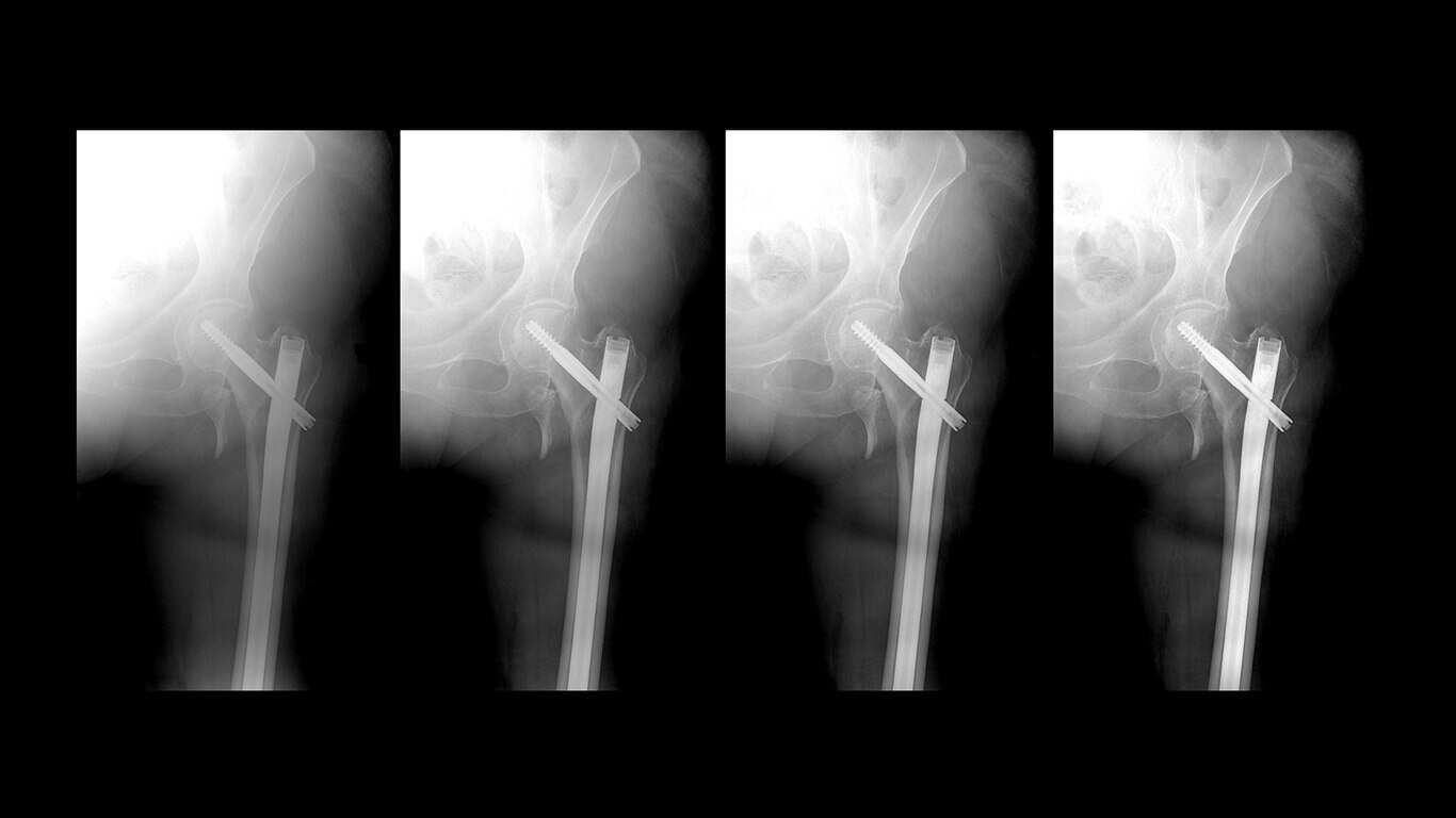 Product Media Carousel Image