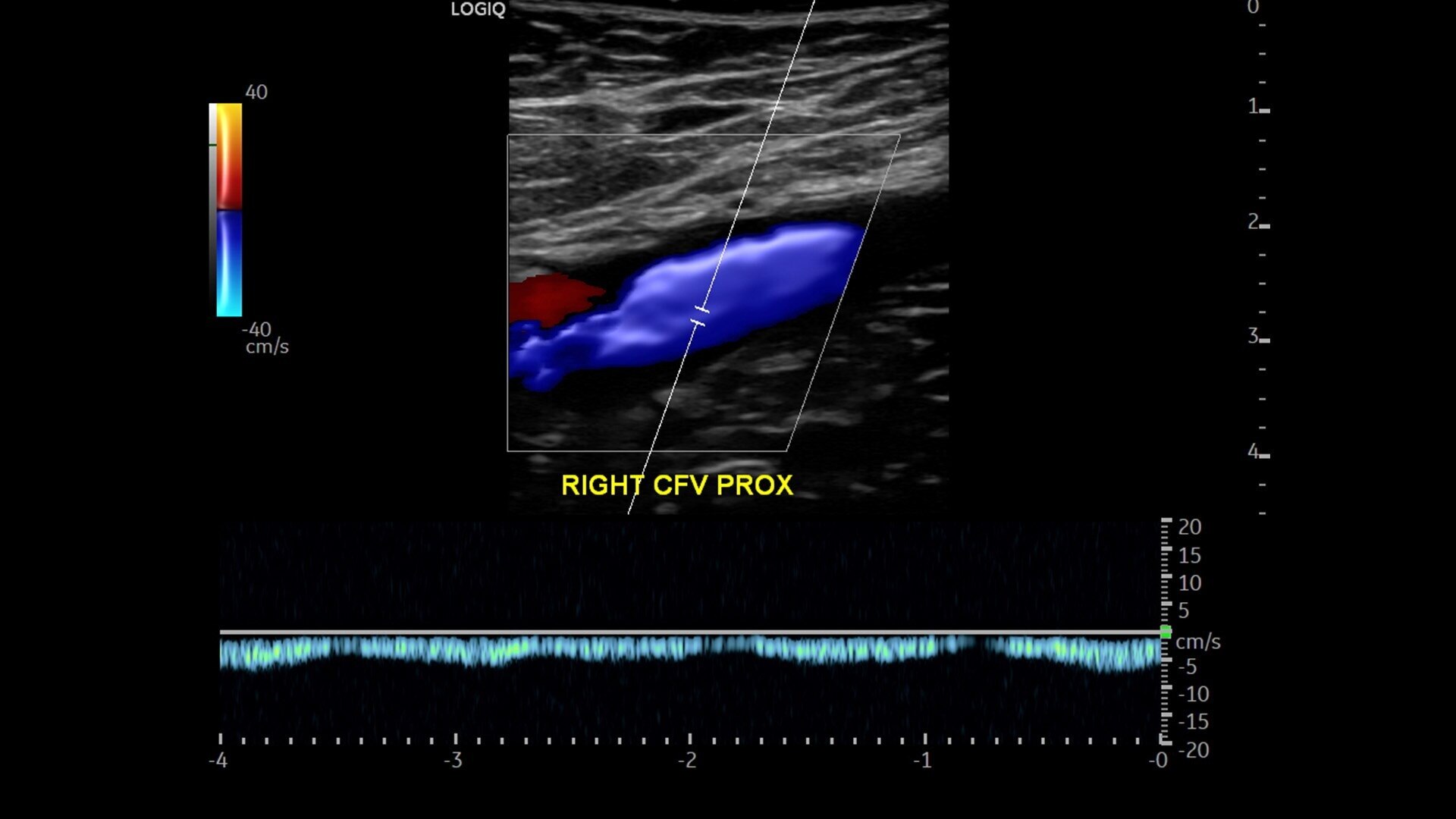 Product Media Carousel Image