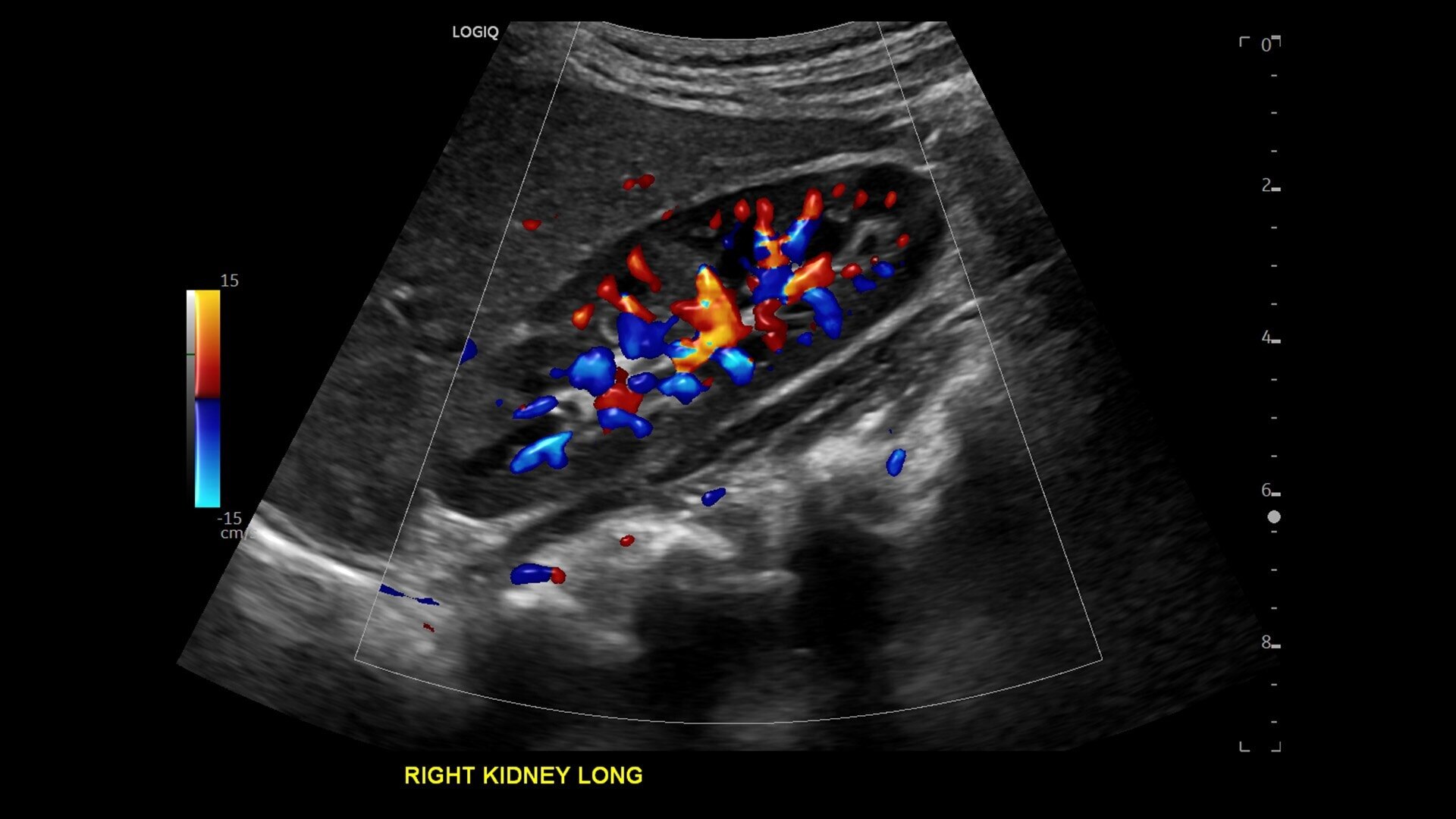 Product Media Carousel Image