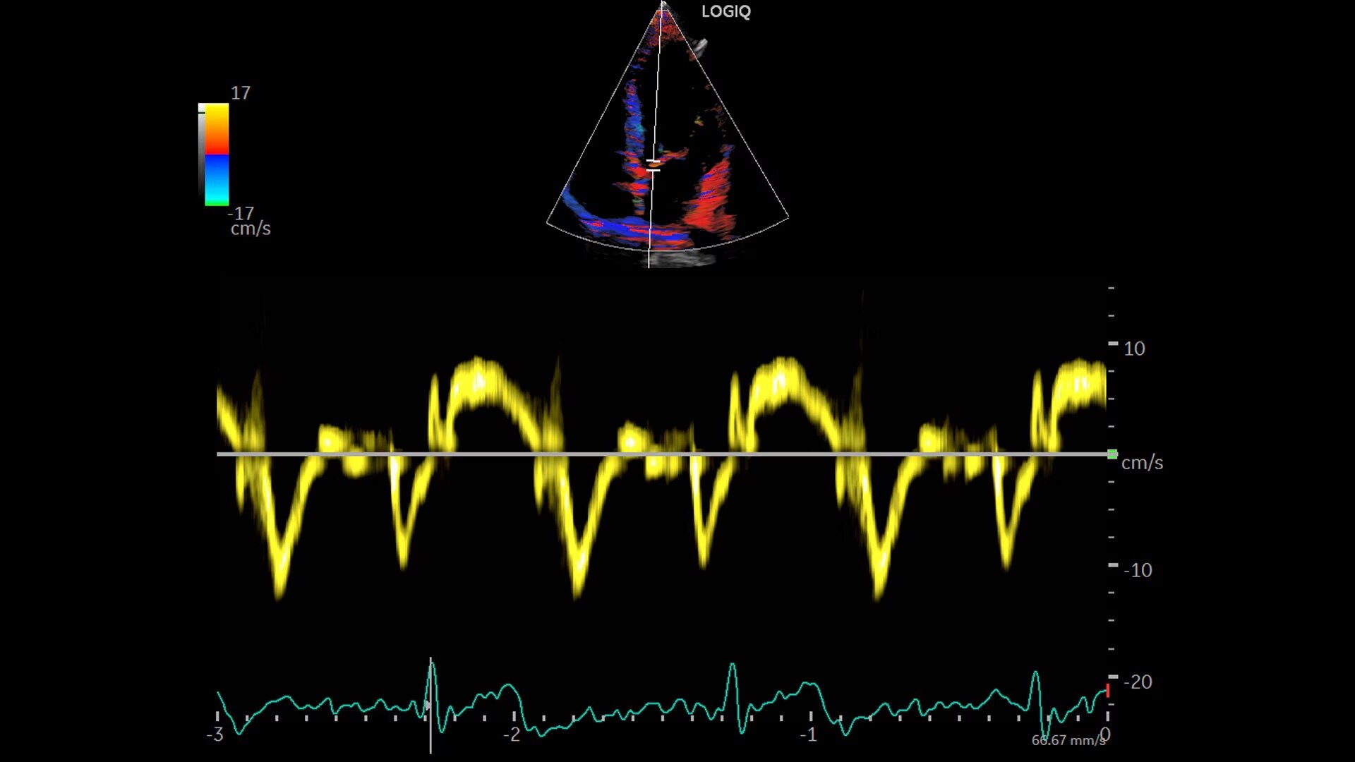 Product Media Carousel Image