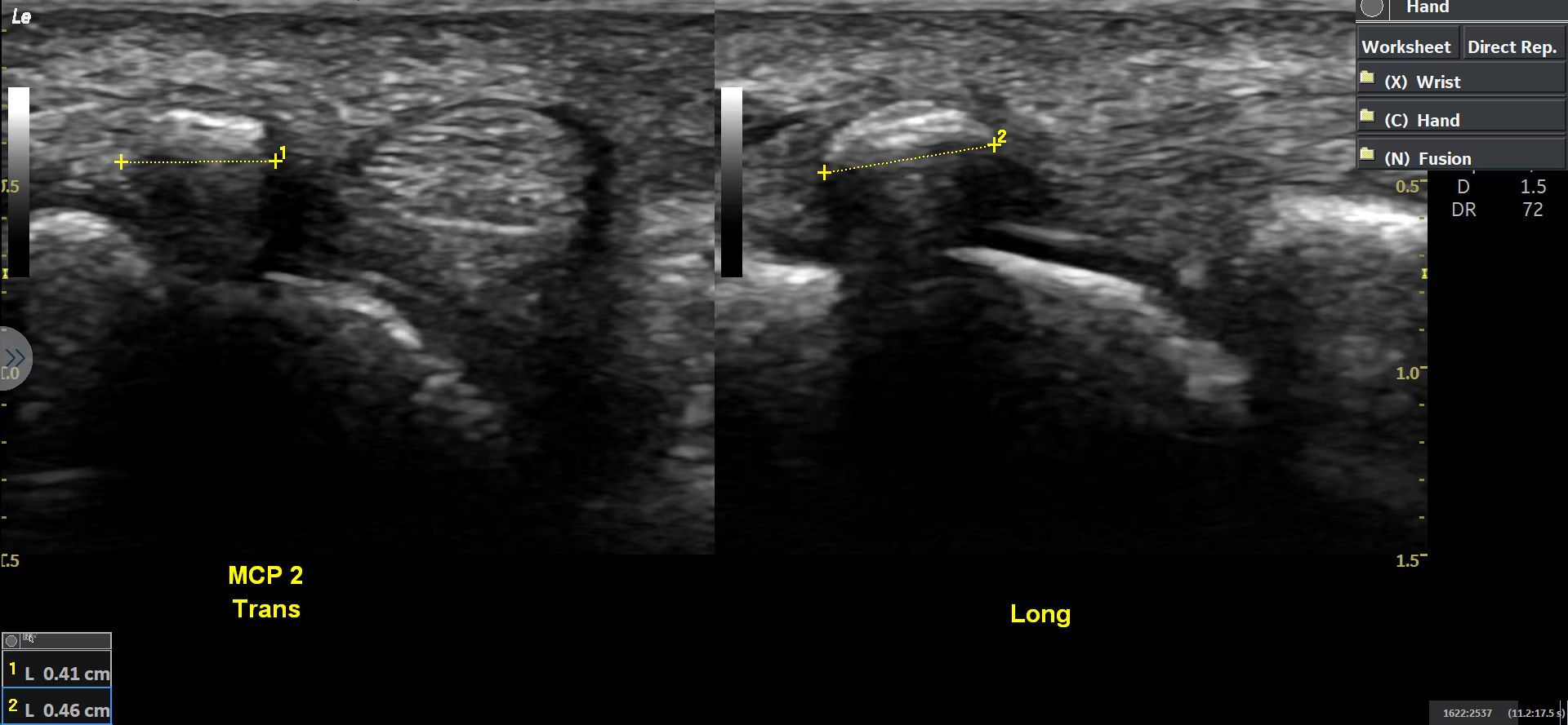 Product Media Carousel Image