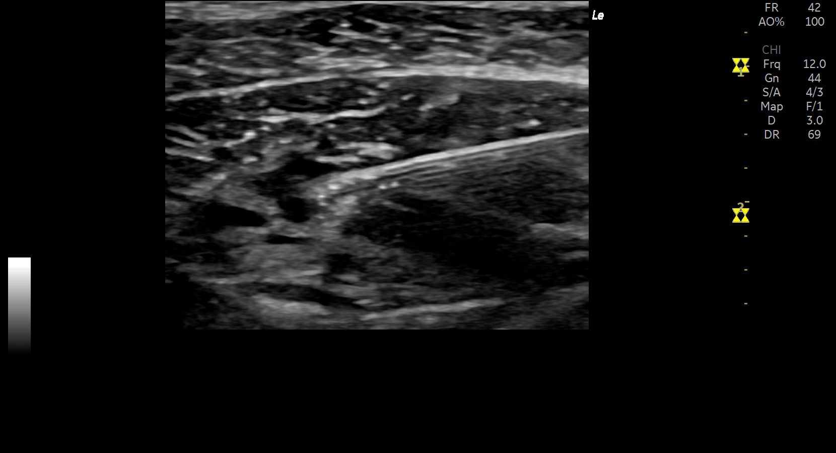 Product Media Carousel Image