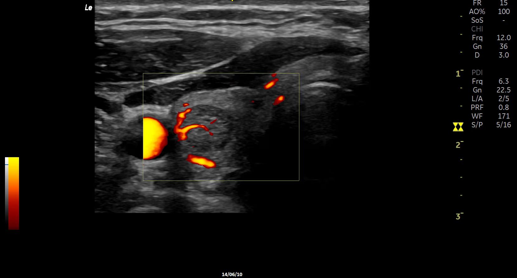 Product Media Carousel Image