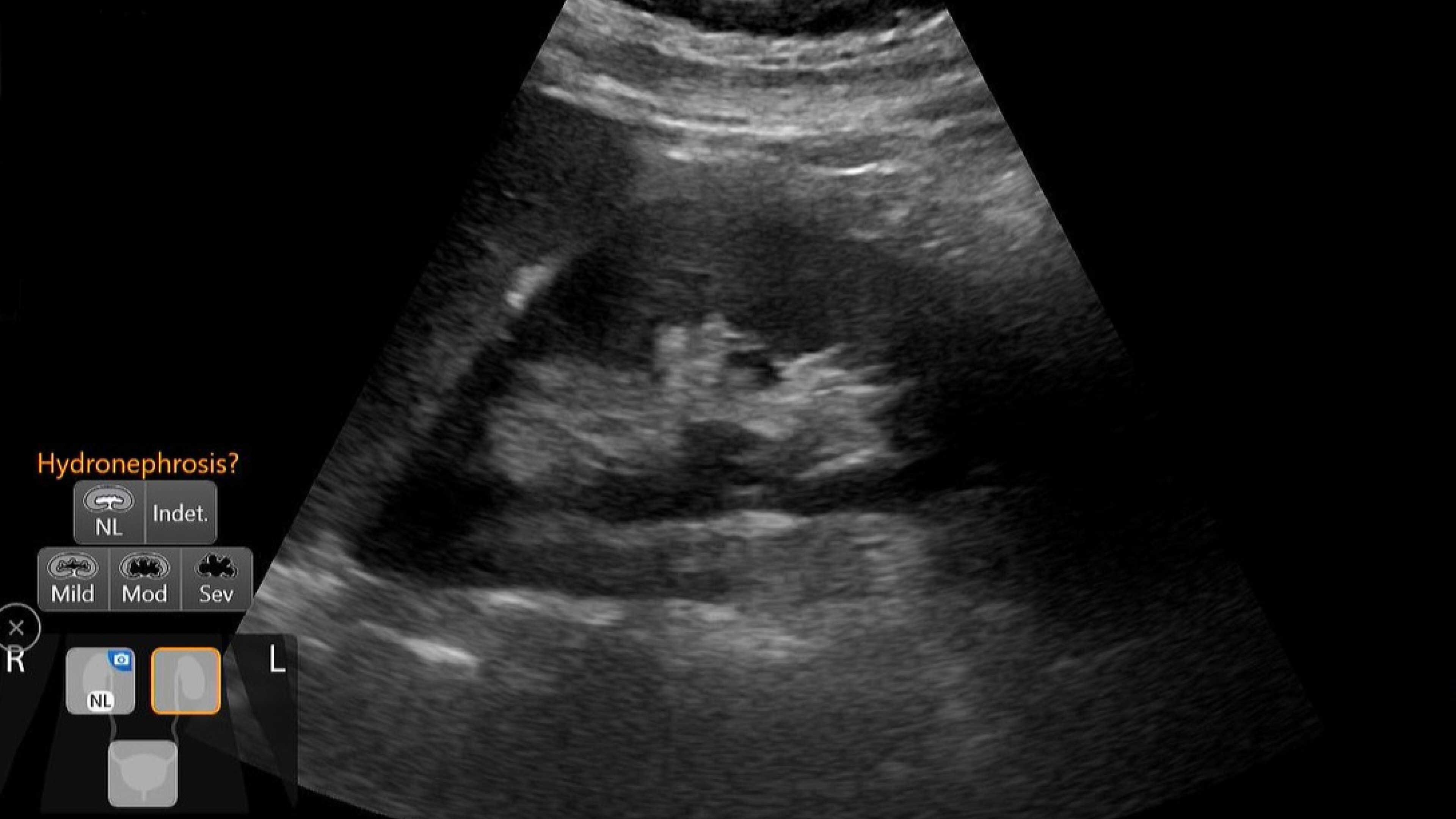 Product Media Carousel Image