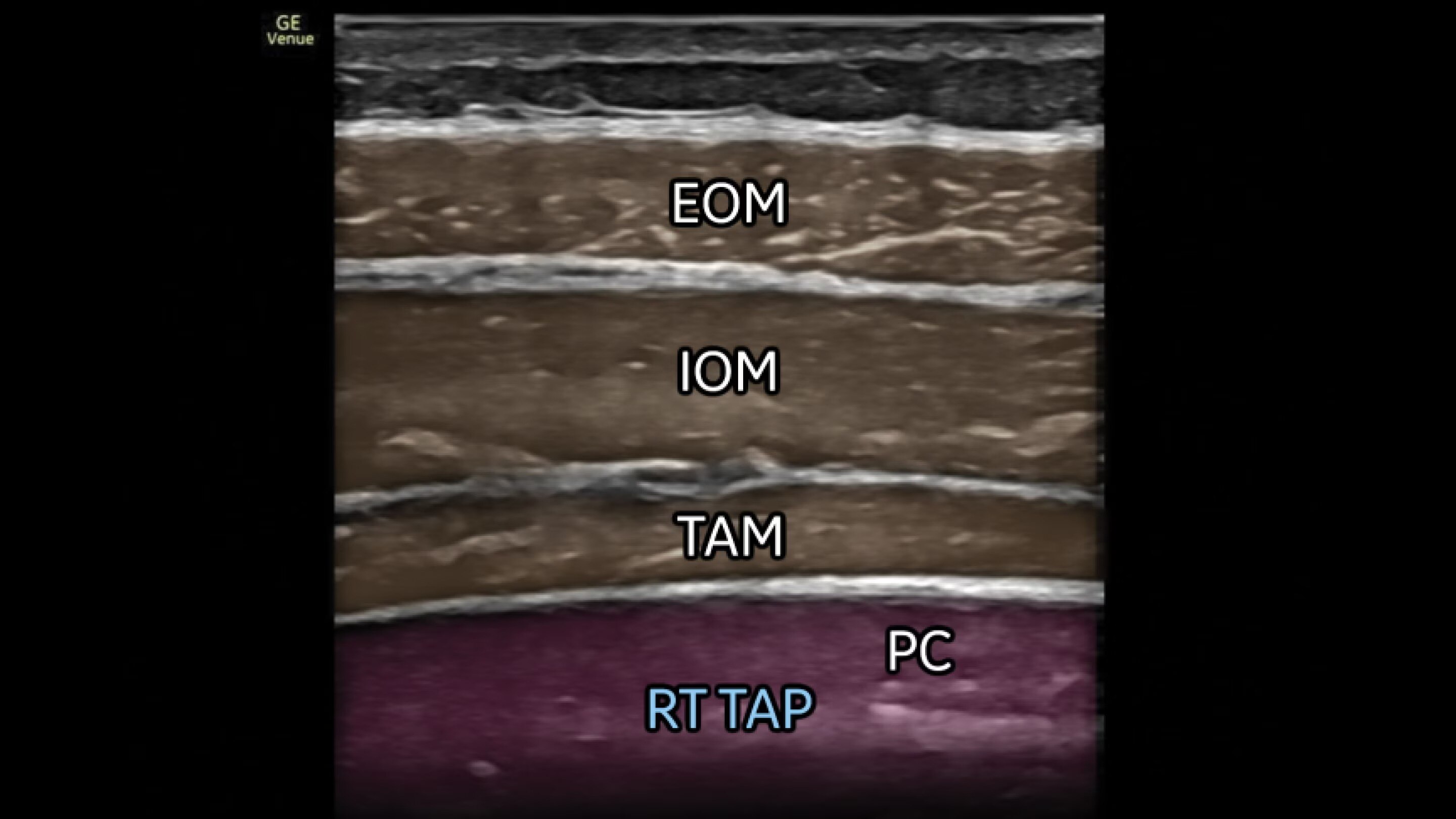 Product Media Carousel Image