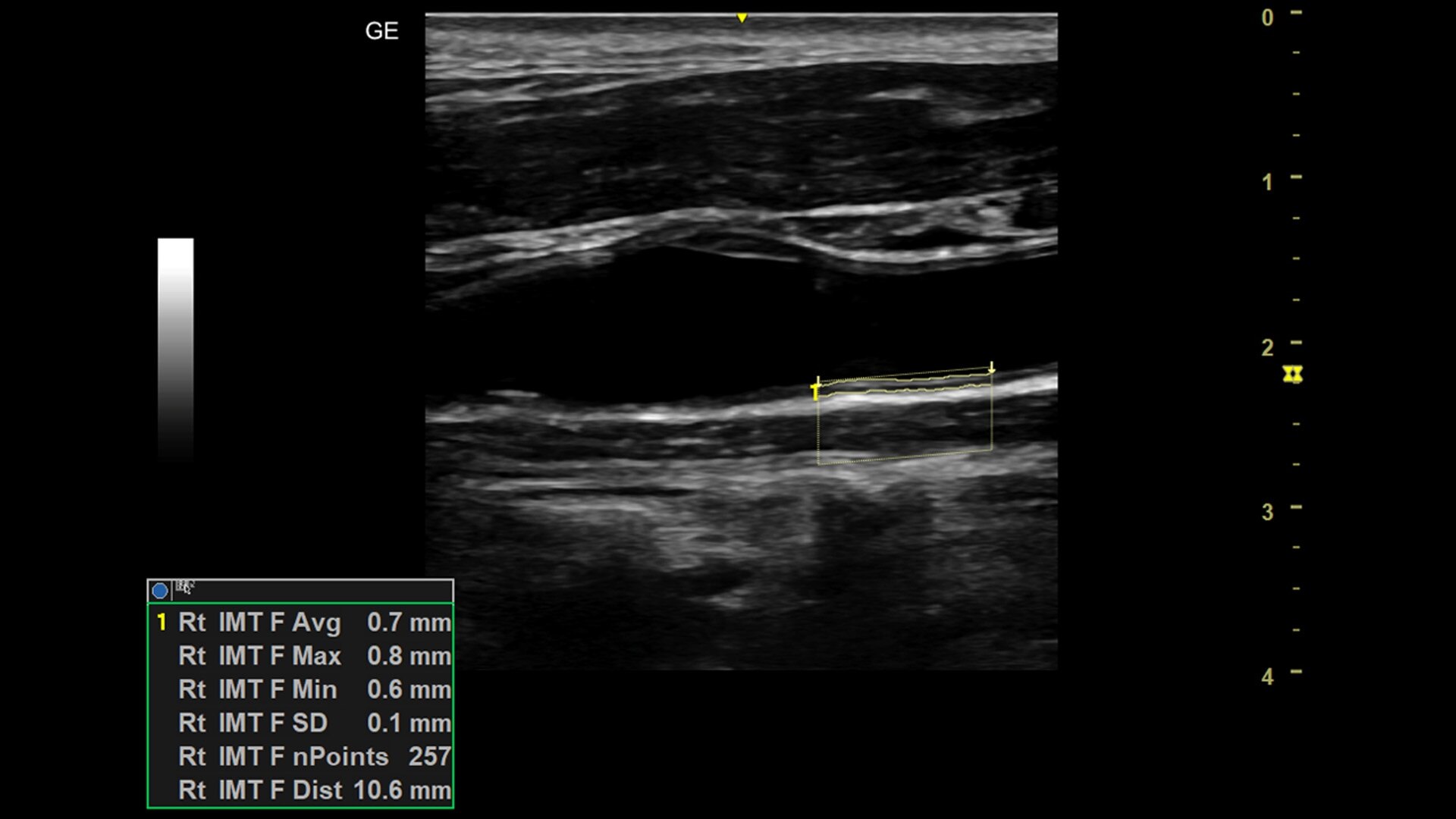 Product Media Carousel Image