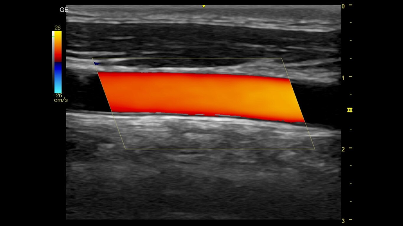 Product Media Carousel Image