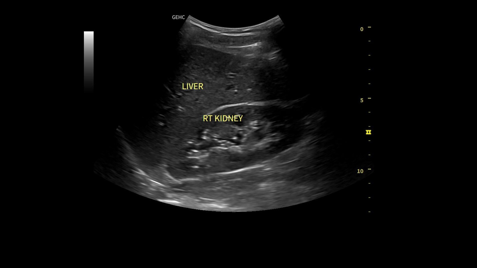 Product Media Carousel Image
