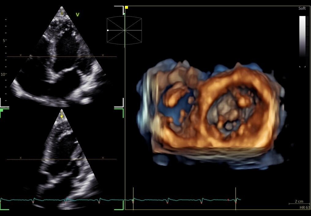 Product Media Carousel Image