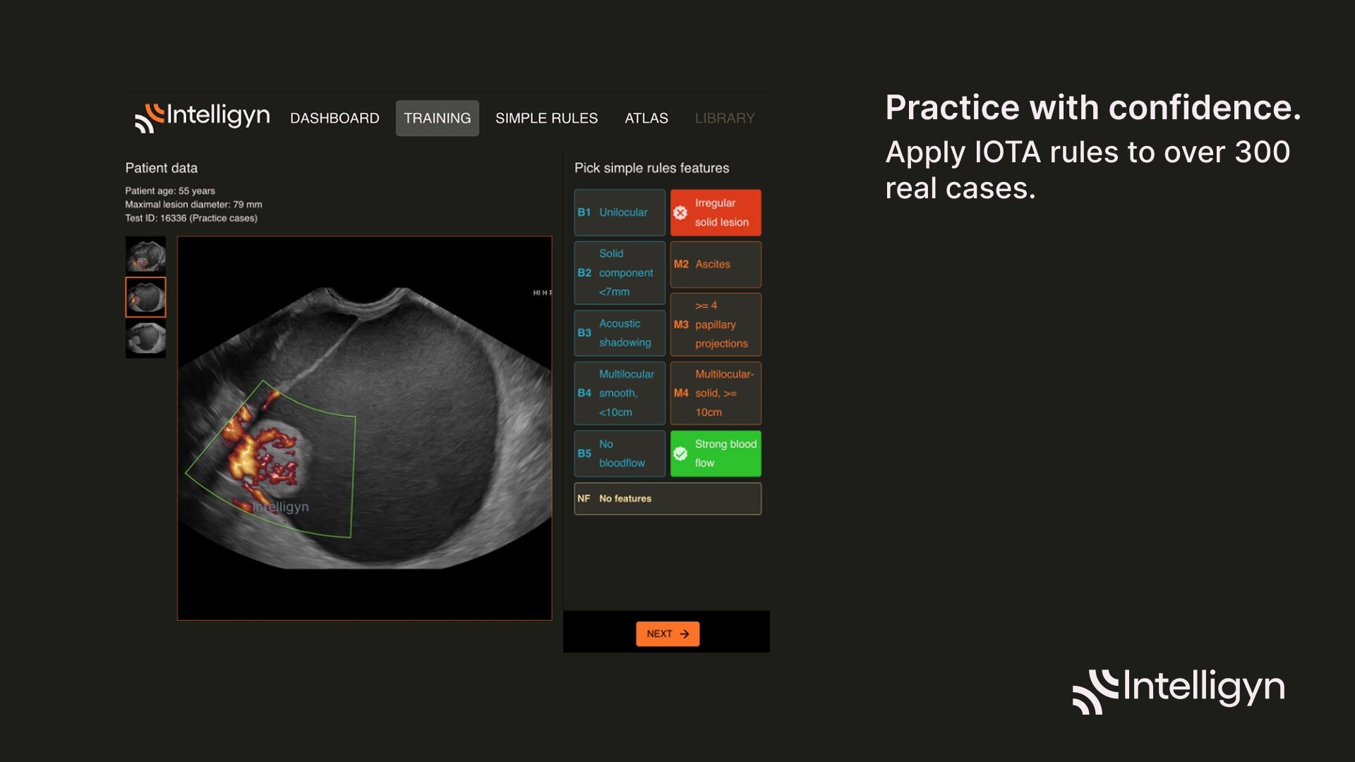 Product Media Carousel Image