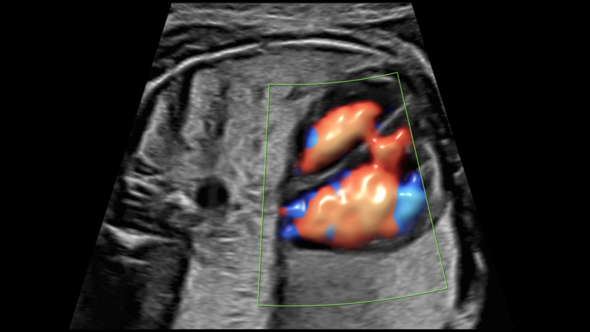 Product Media Carousel Image