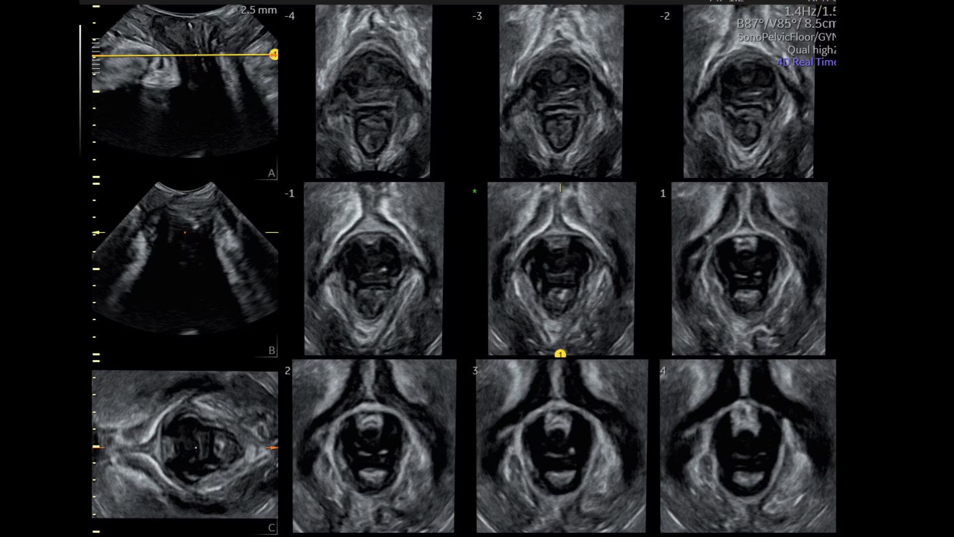 Product Media Carousel Image