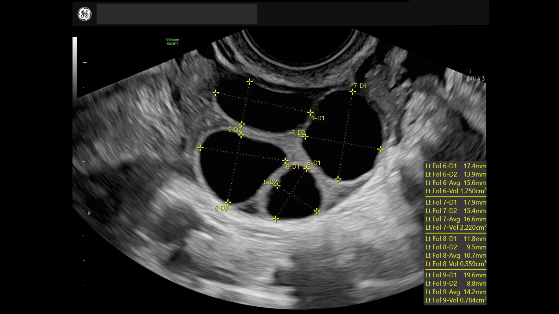 Product Media Carousel Image