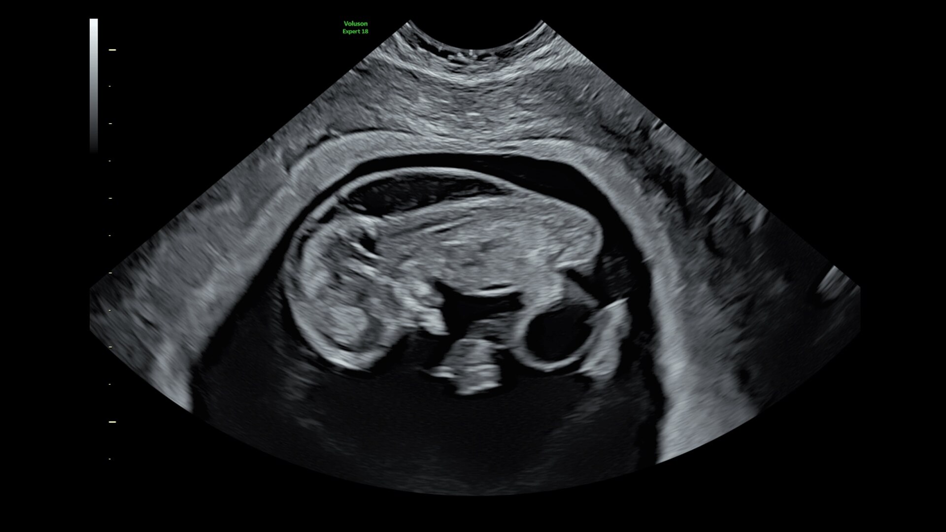 Product Media Carousel Image