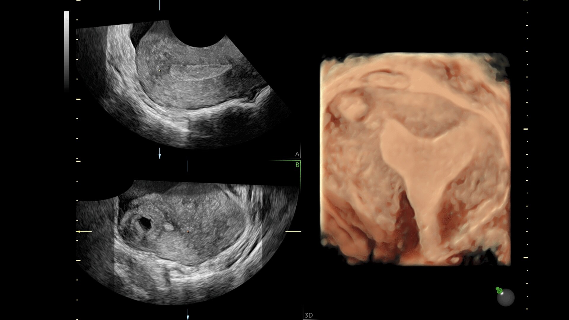 Product Media Carousel Image