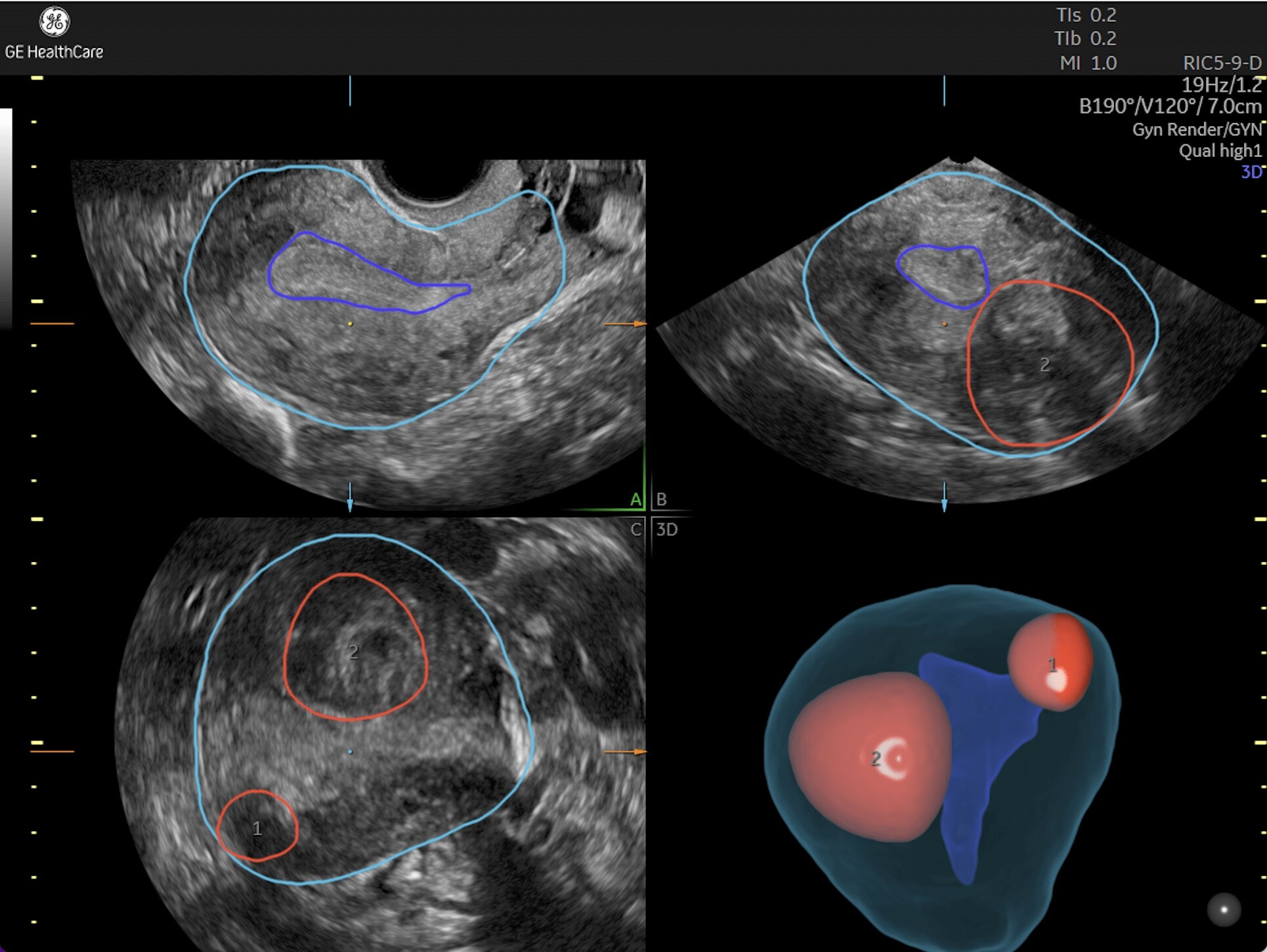 Product Media Carousel Image