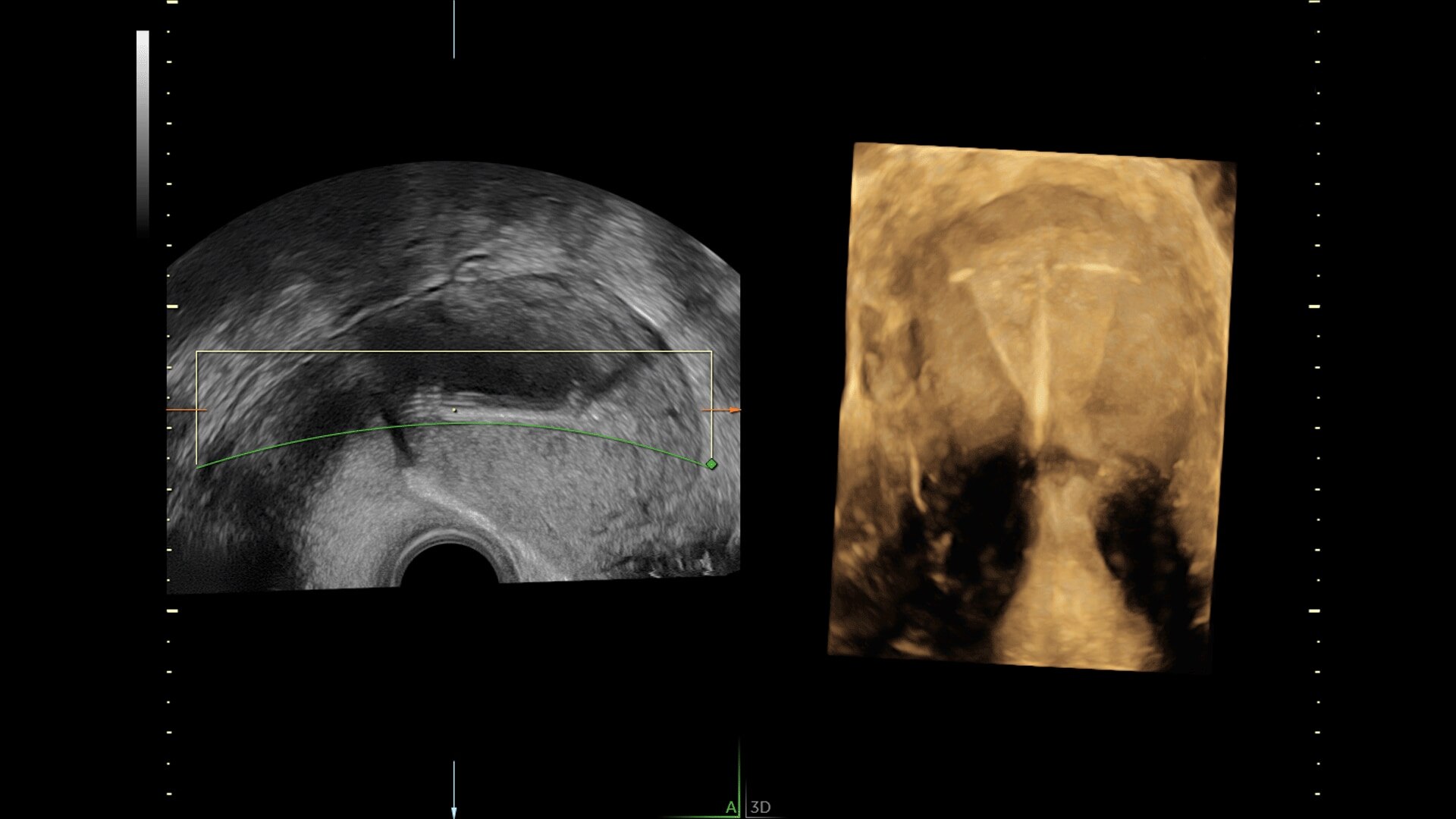 Product Media Carousel Image