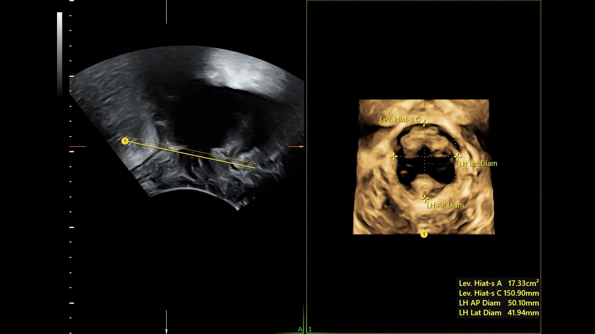 Product Media Carousel Image