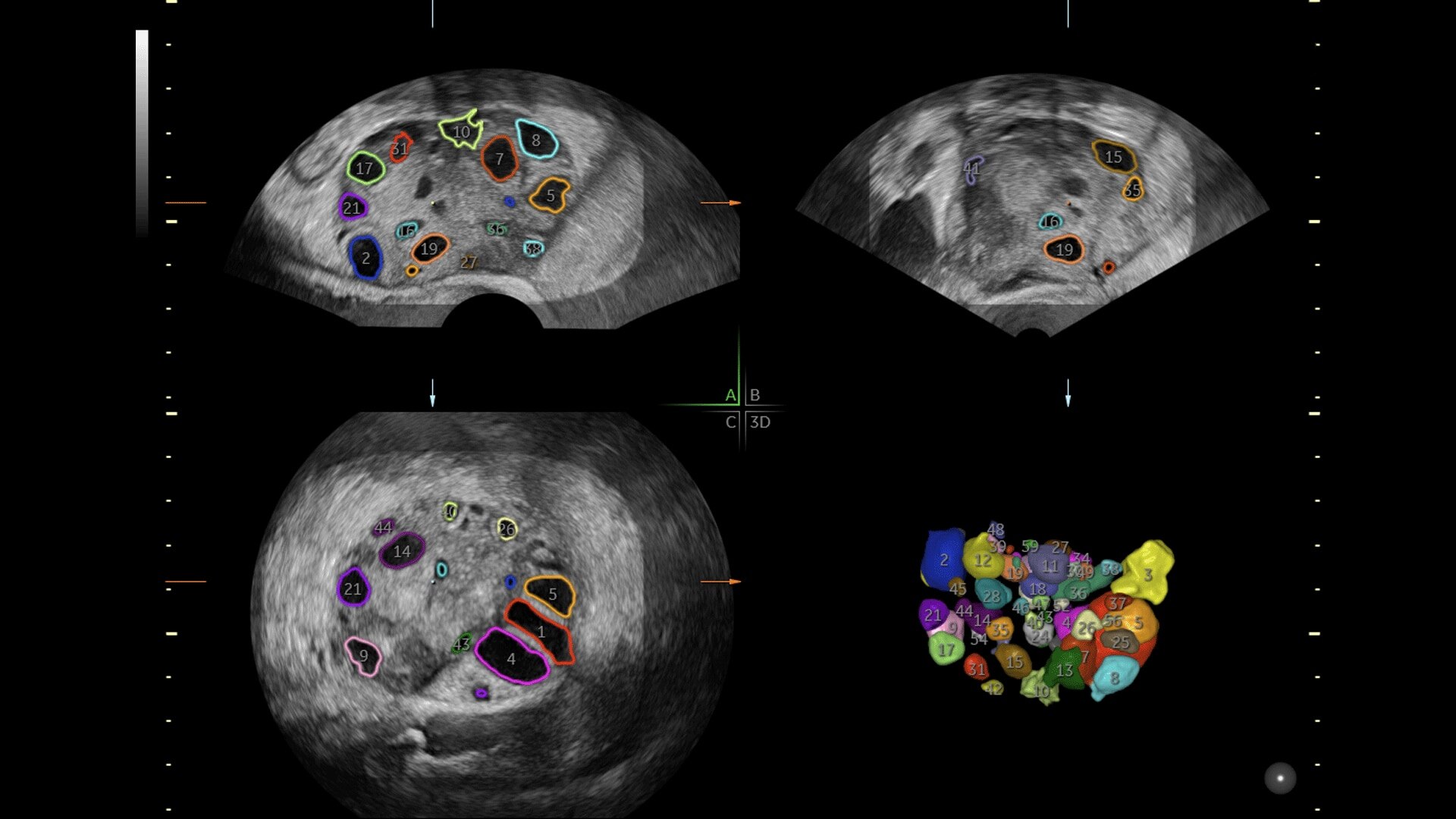 Product Media Carousel Image
