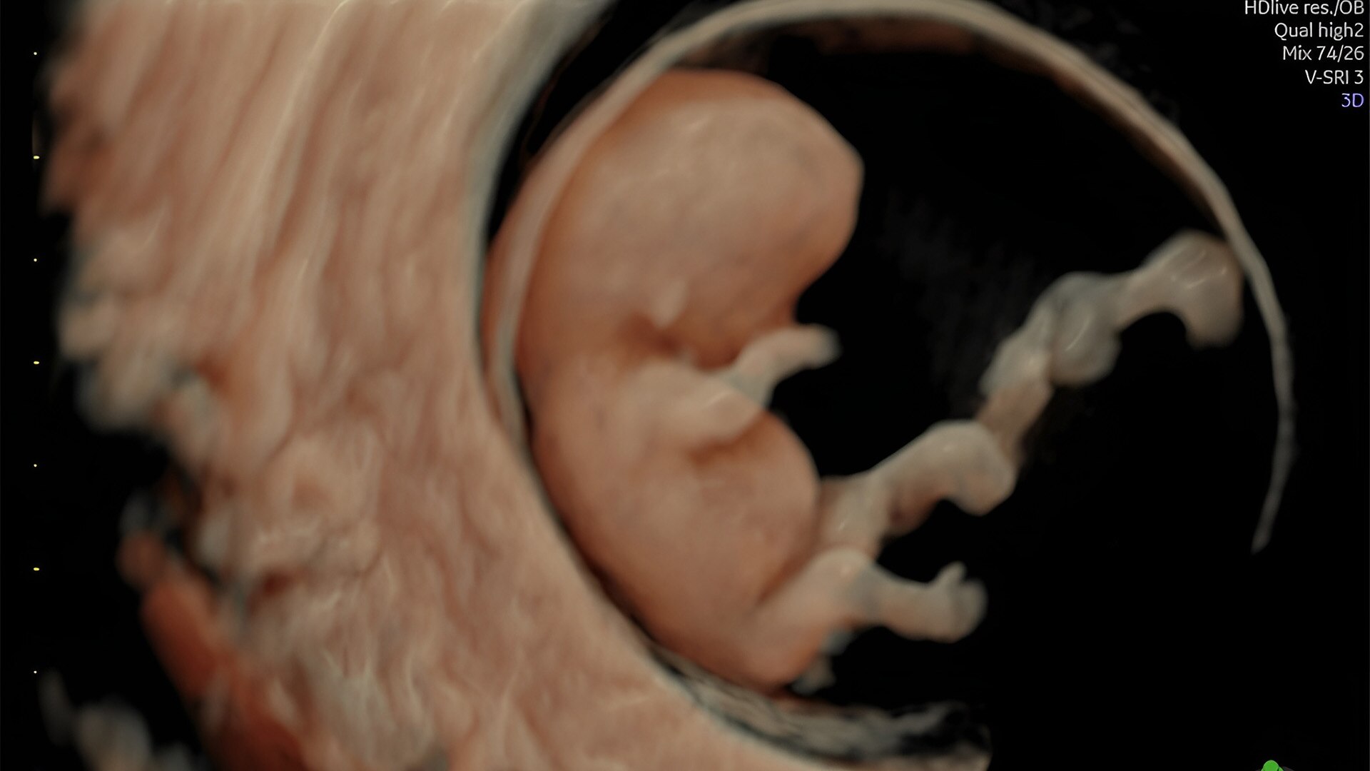 Product Media Carousel Image