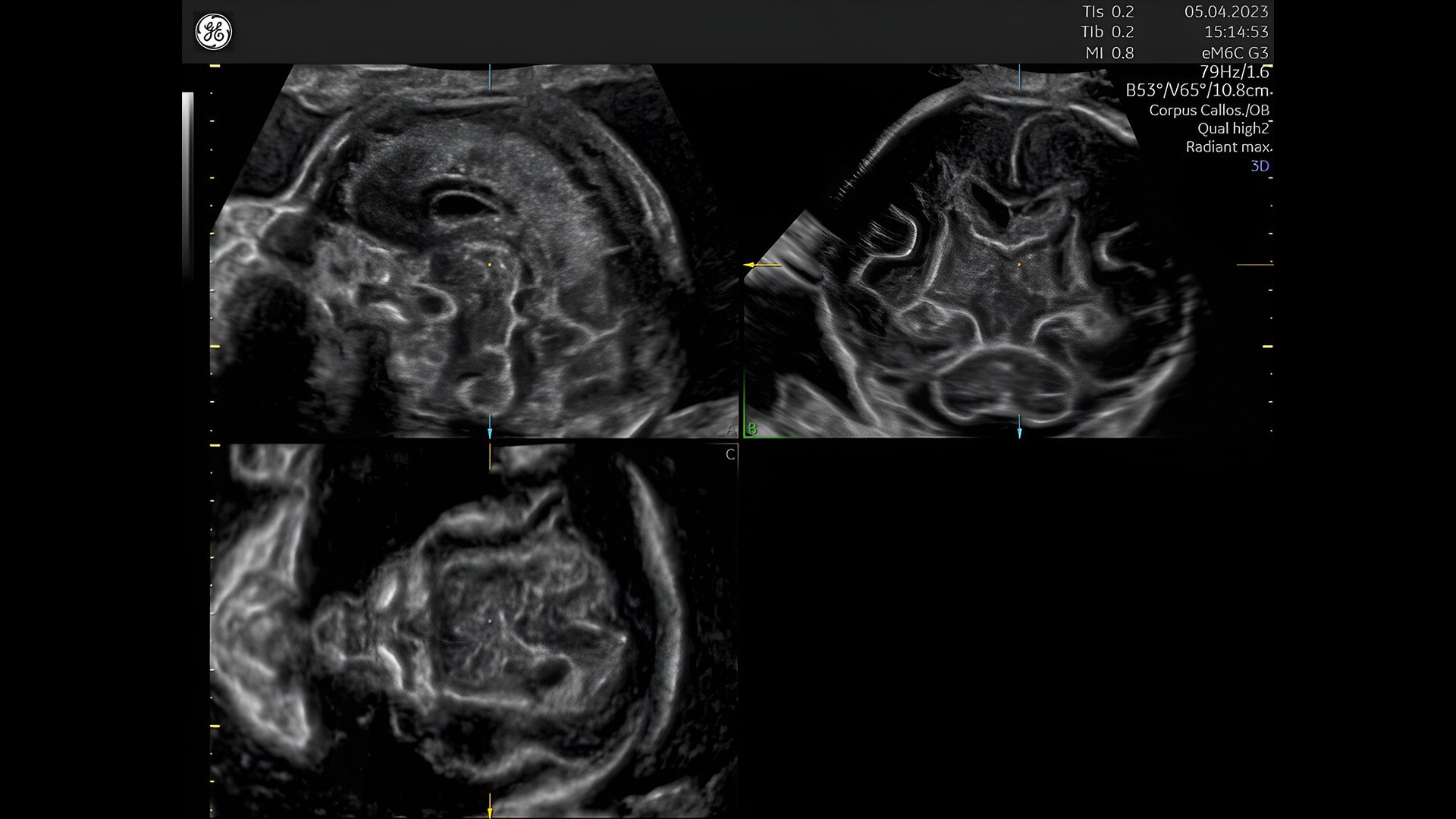 Product Media Carousel Image