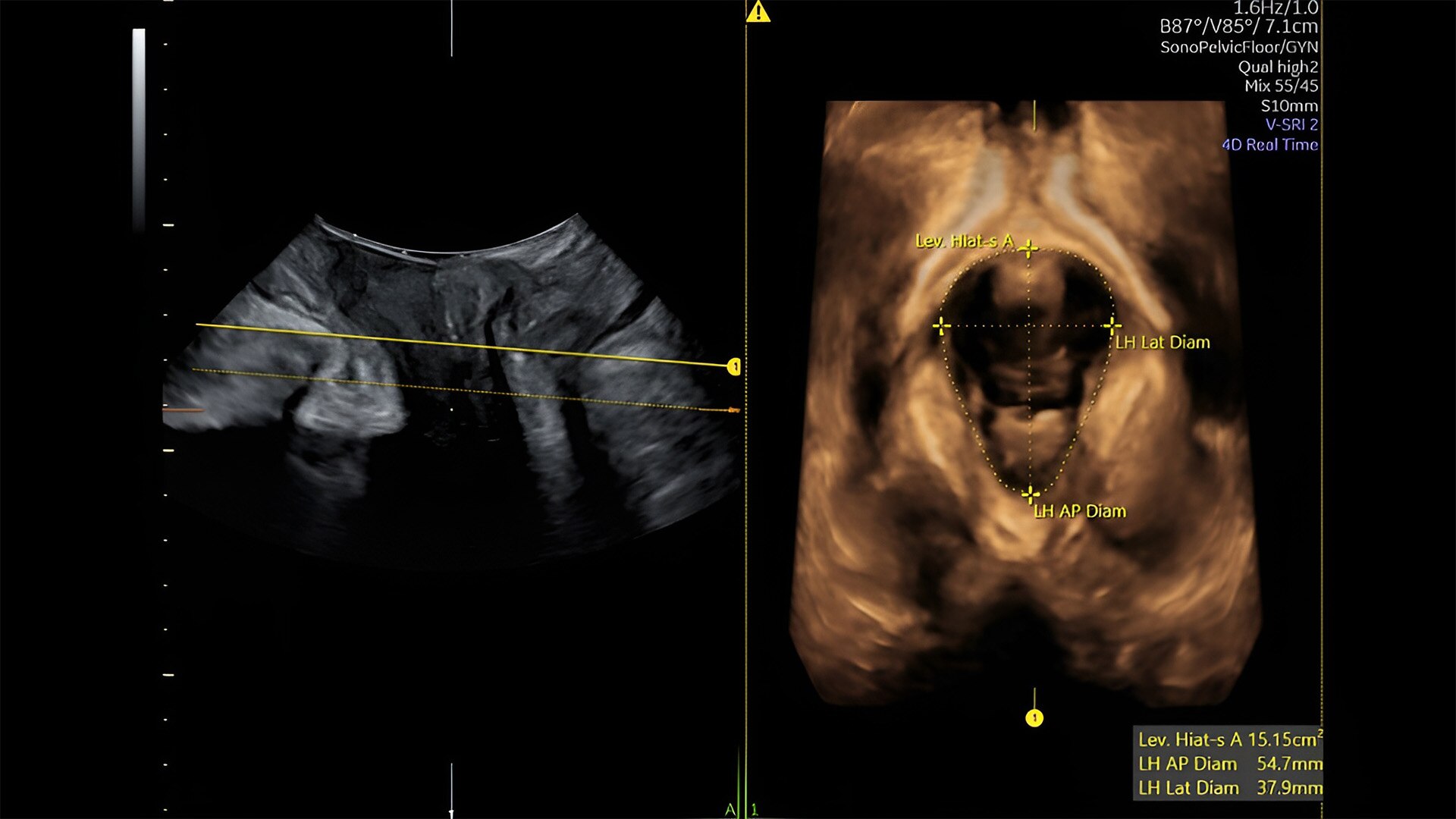 Product Media Carousel Image