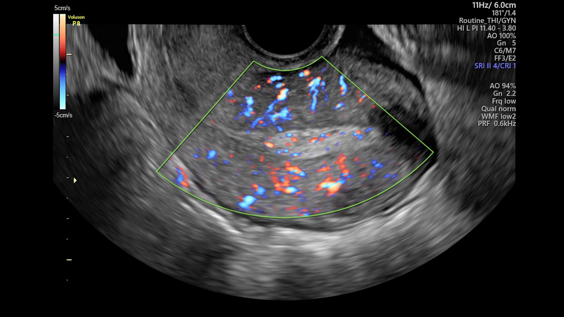 Product Media Carousel Image
