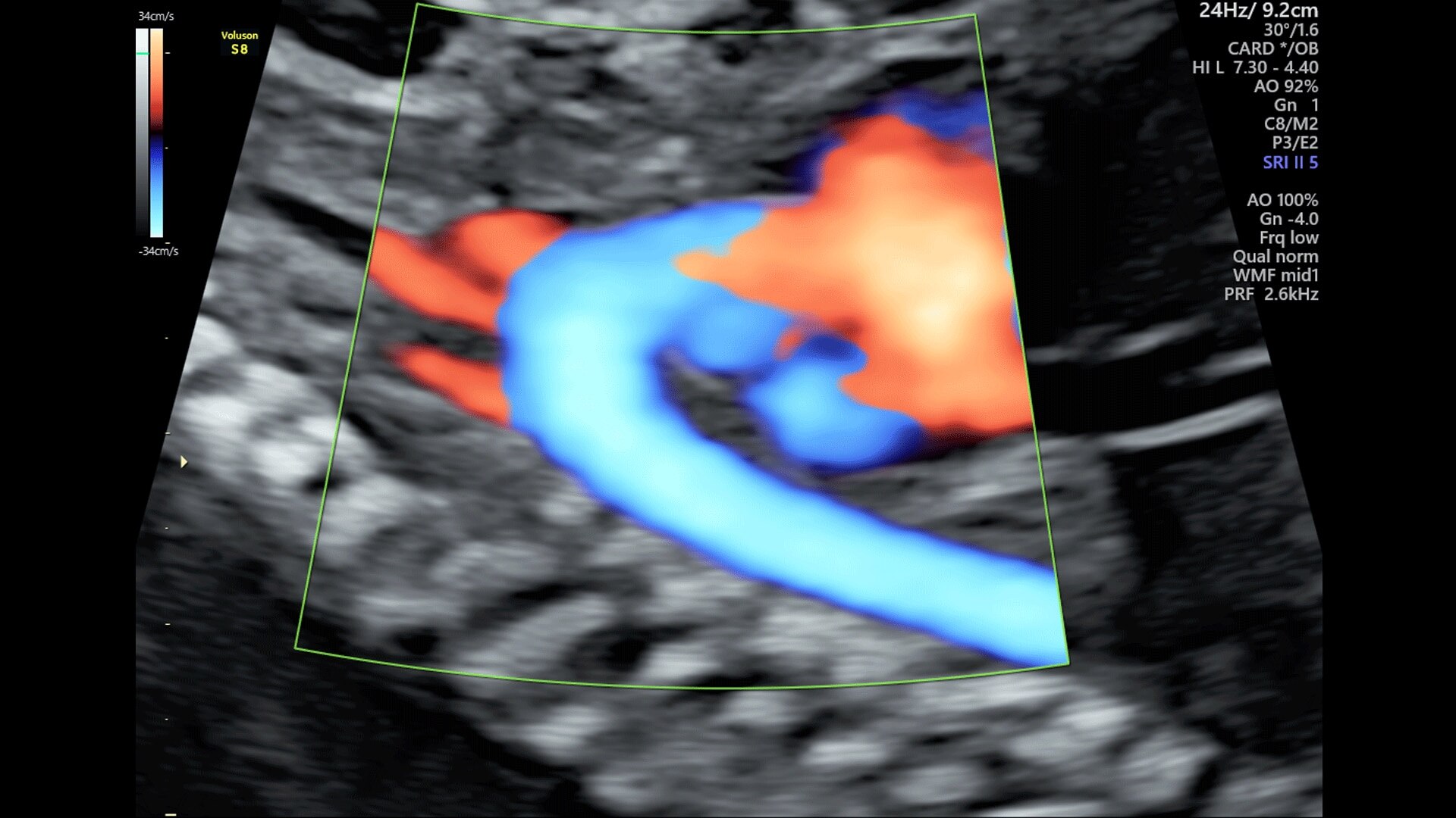 Product Media Carousel Image