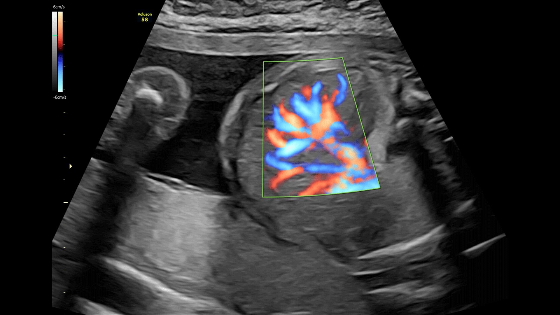 Product Media Carousel Image