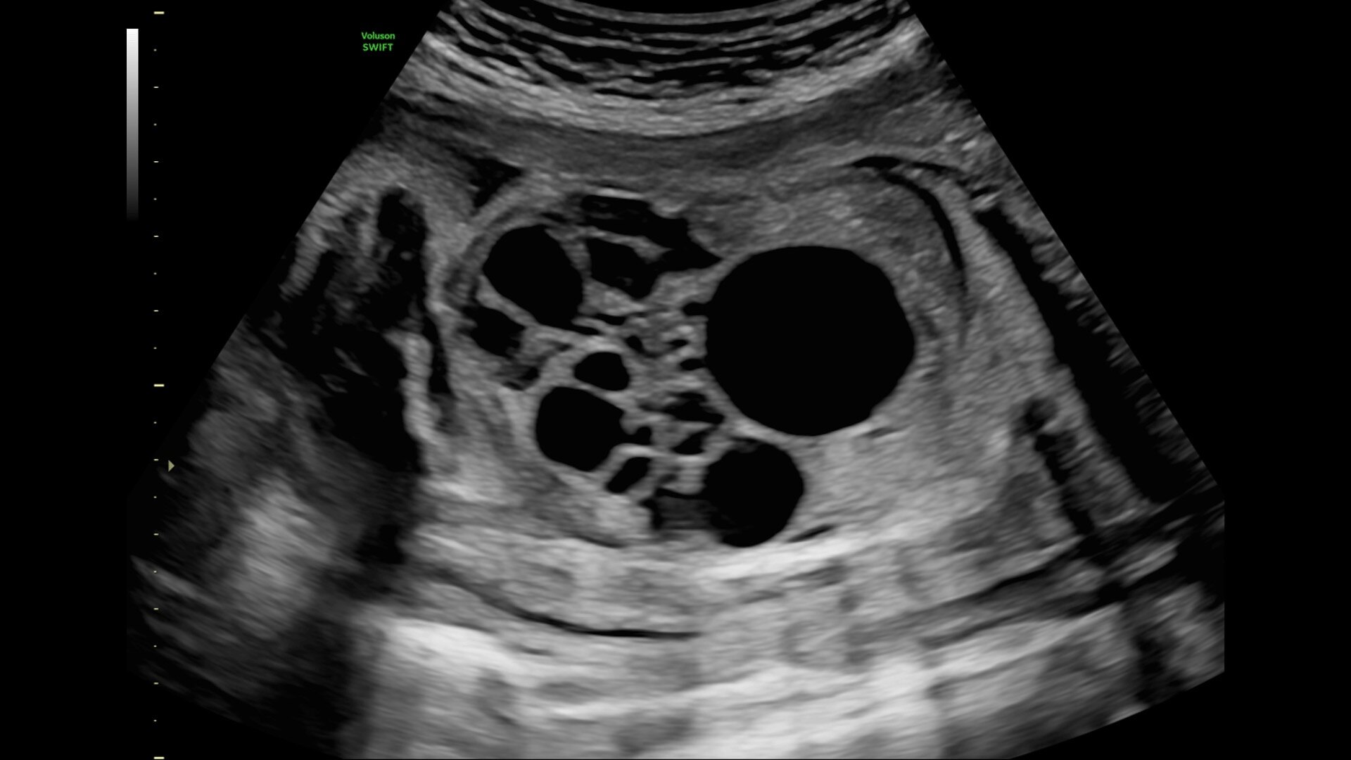 Product Media Carousel Image