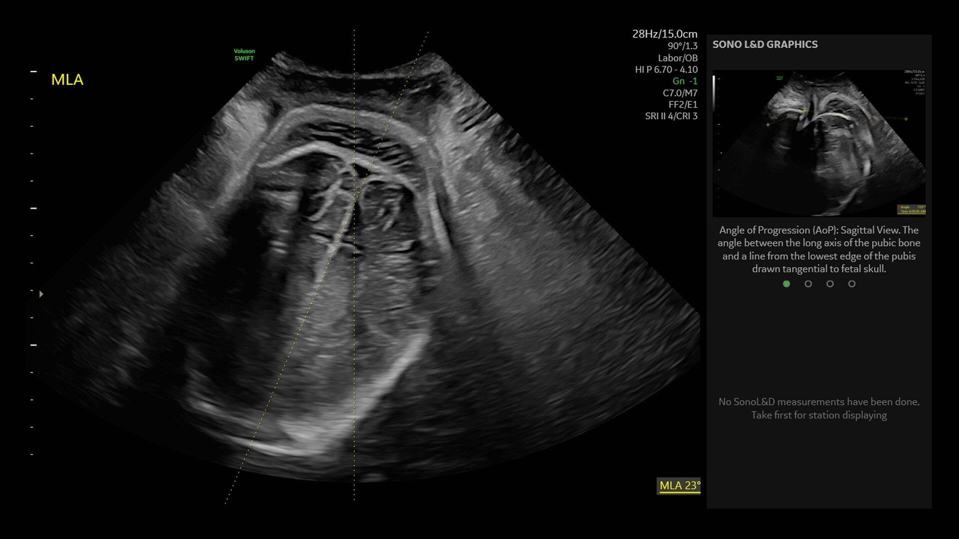 Product Media Carousel Image