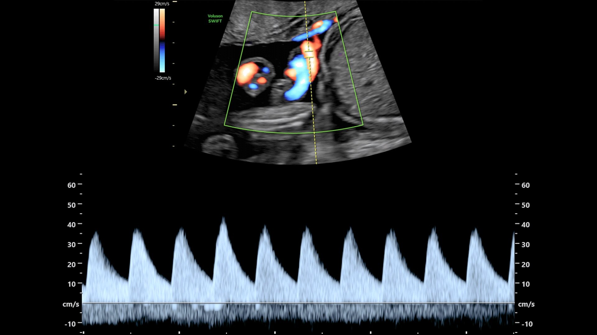 Product Media Carousel Image