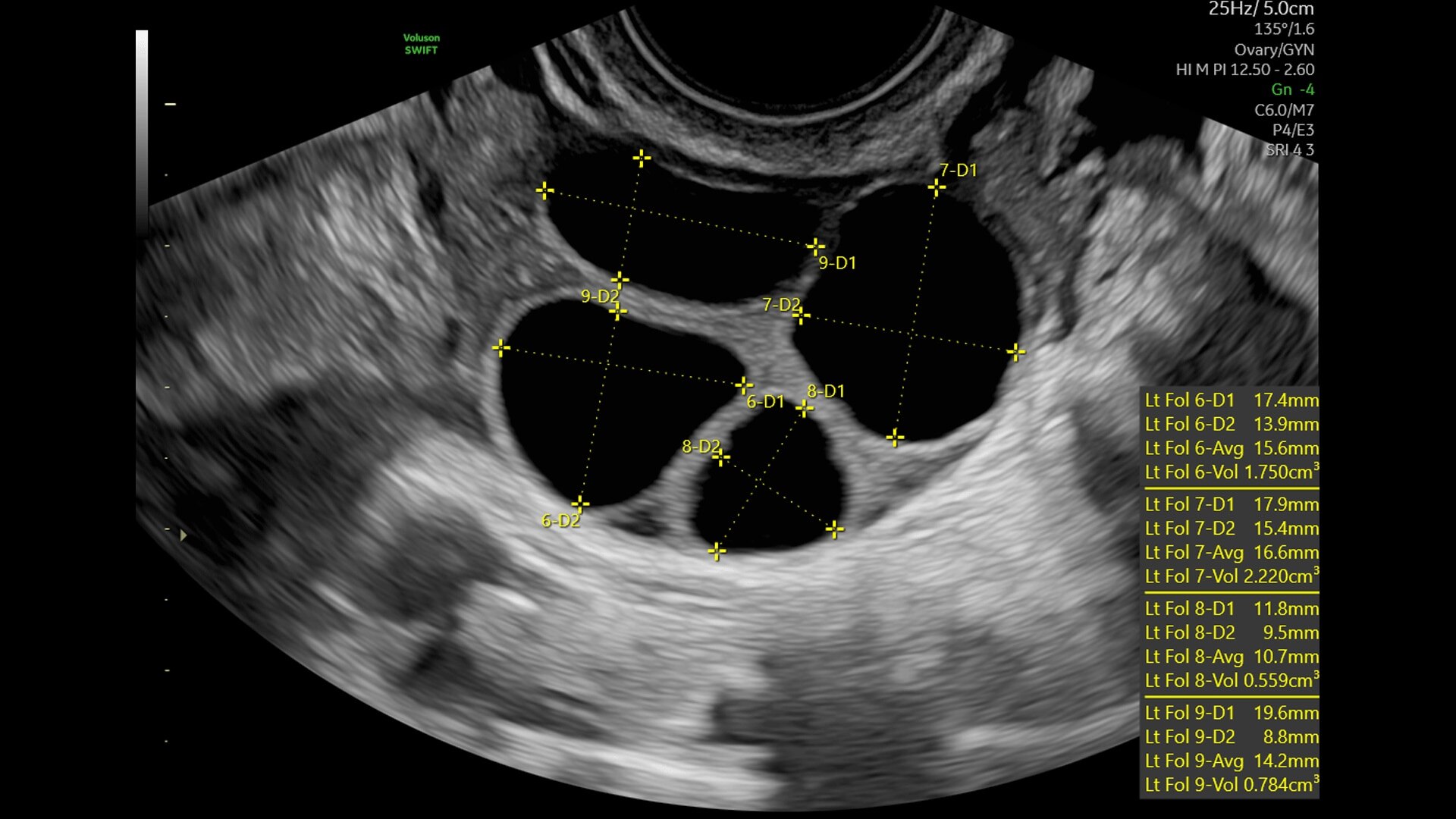 Product Media Carousel Image