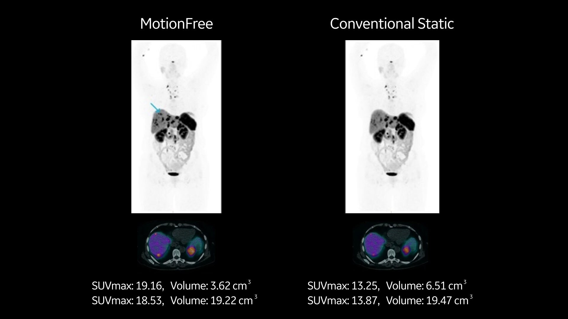 Product Media Carousel Image