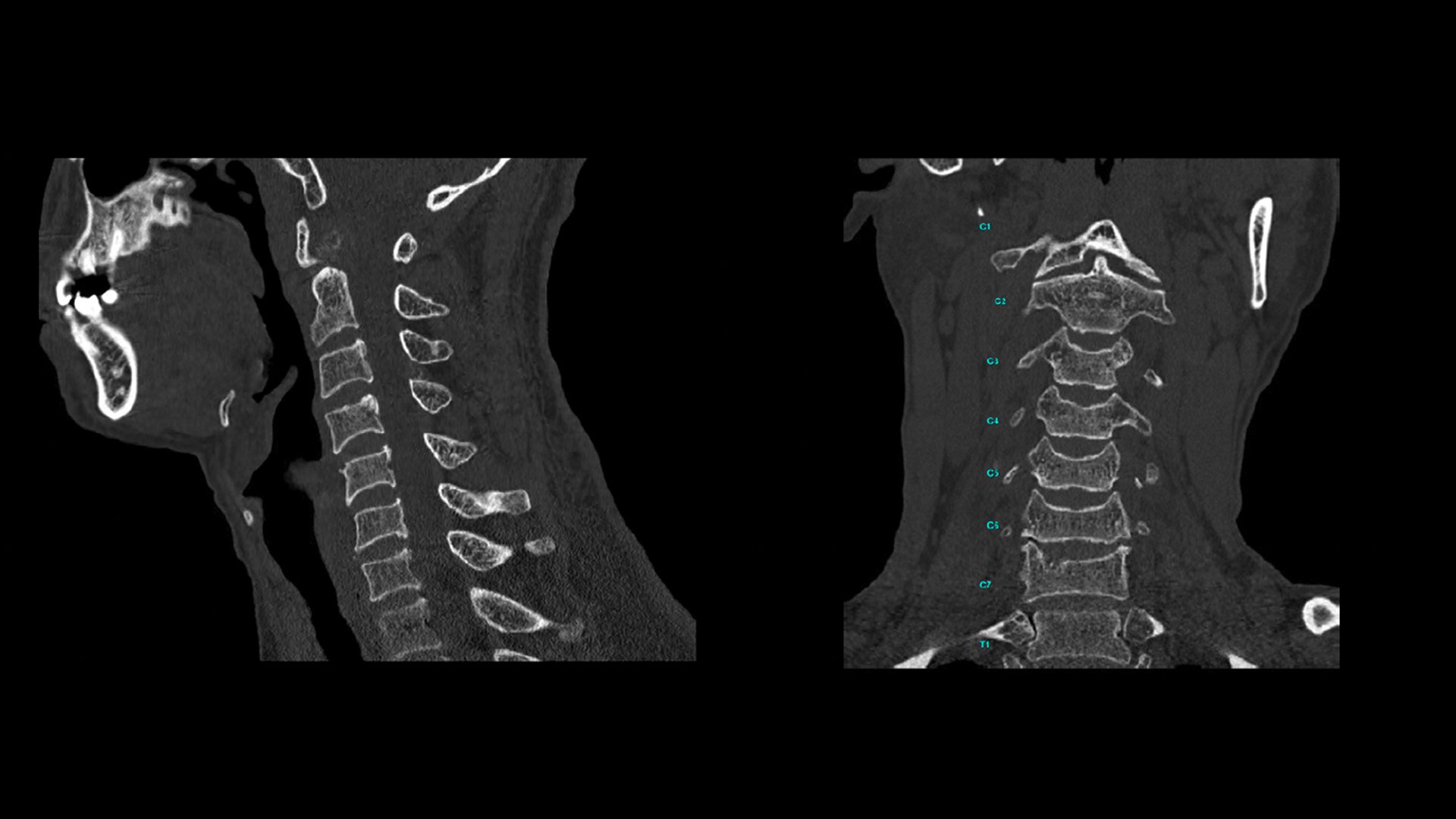 Product Media Carousel Image