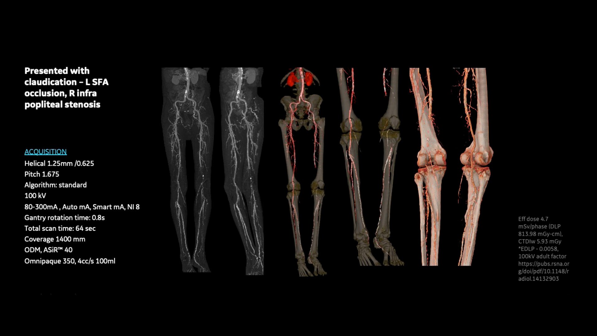 Product Media Carousel Image