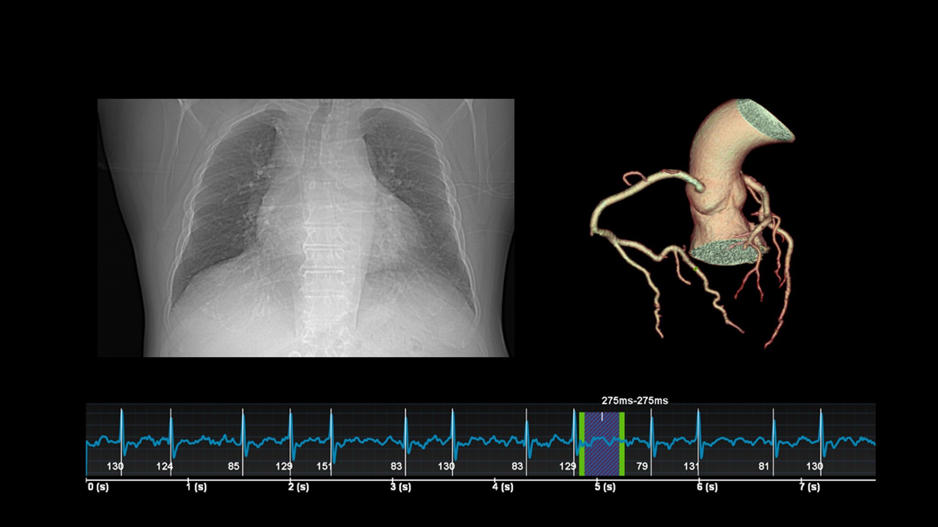 Product Media Carousel Image