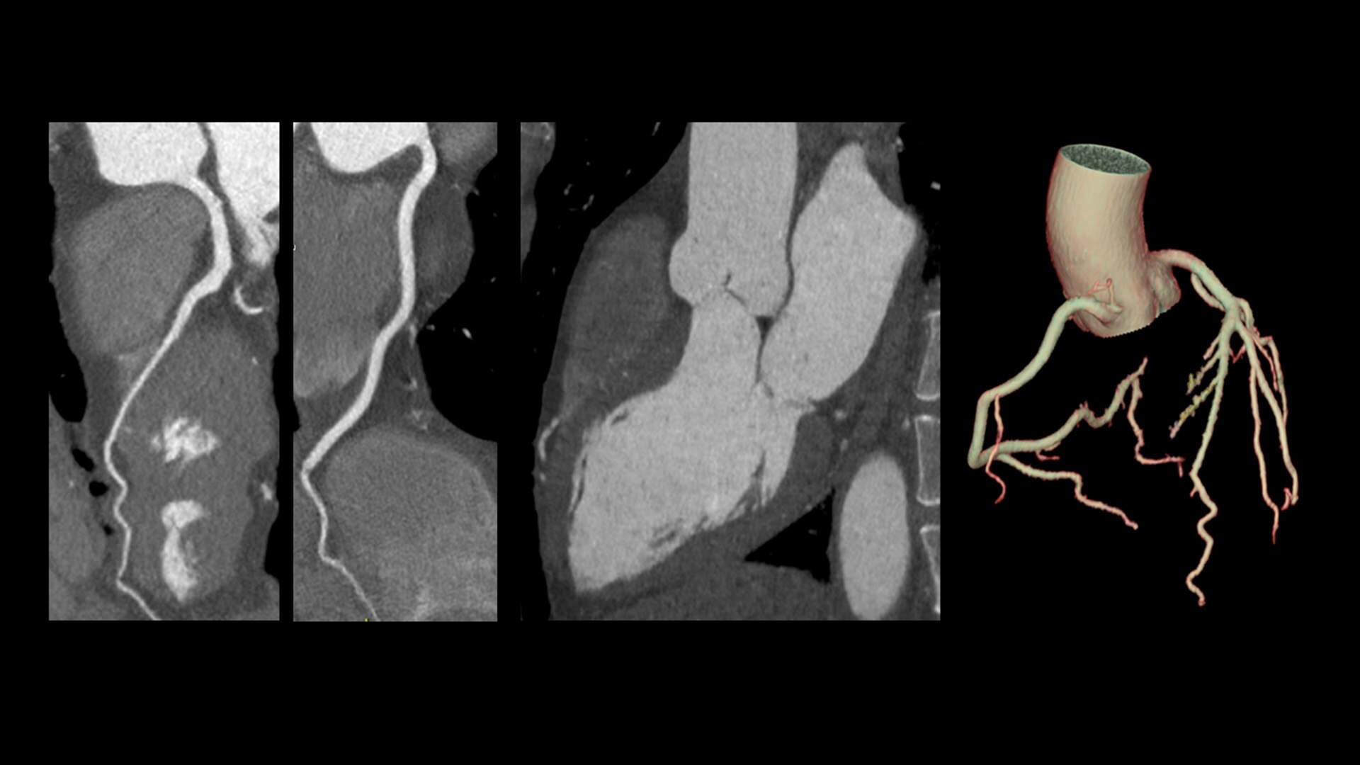 Product Media Carousel Image