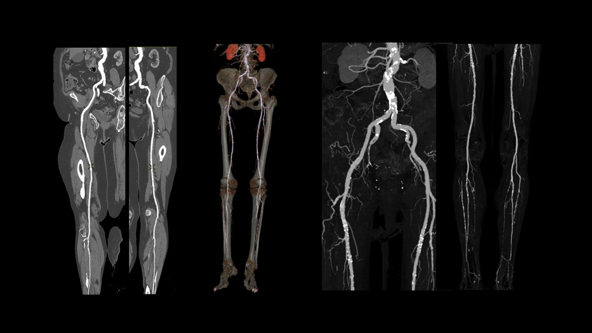 Product Media Carousel Image