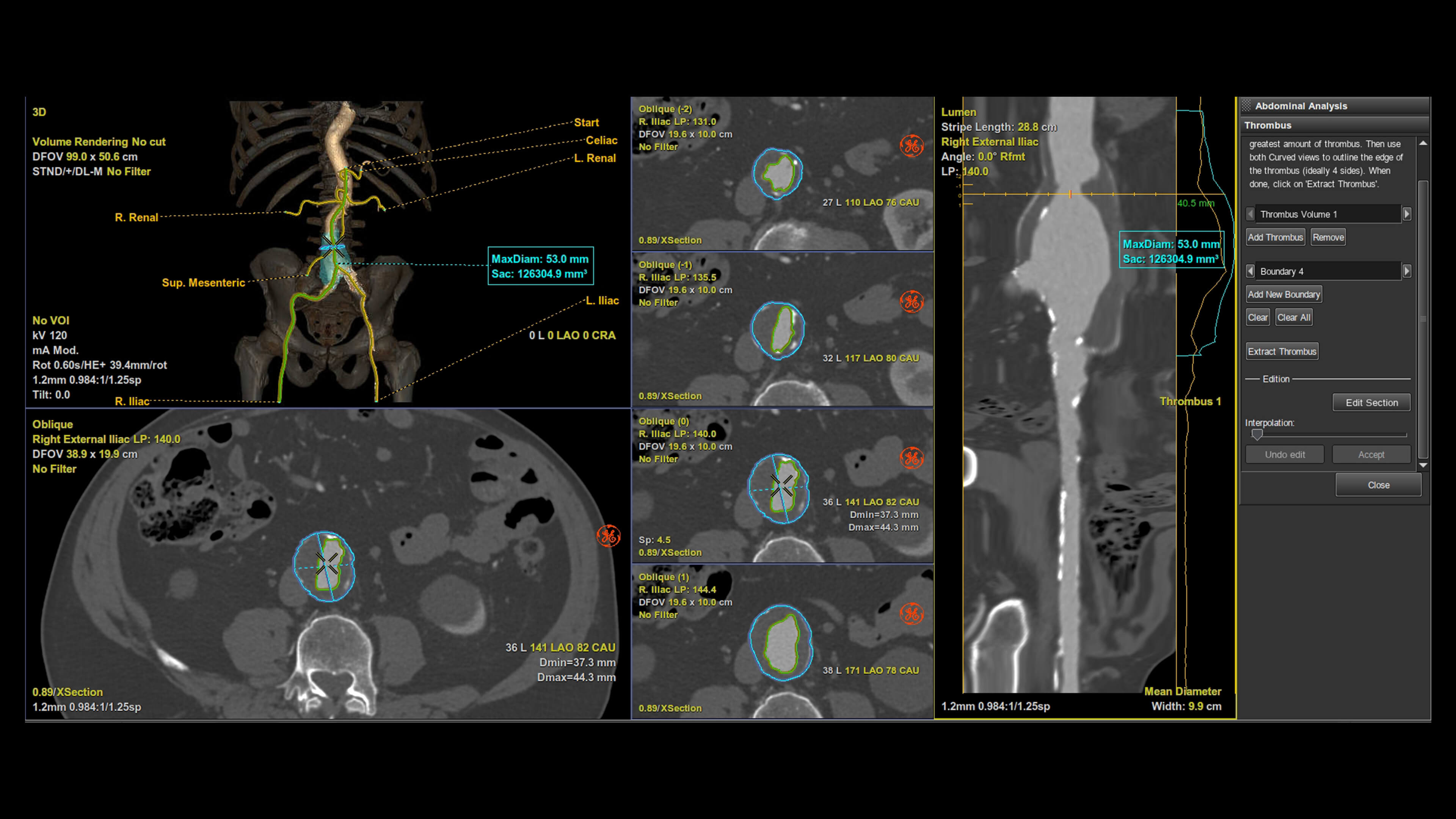Product Media Carousel Image
