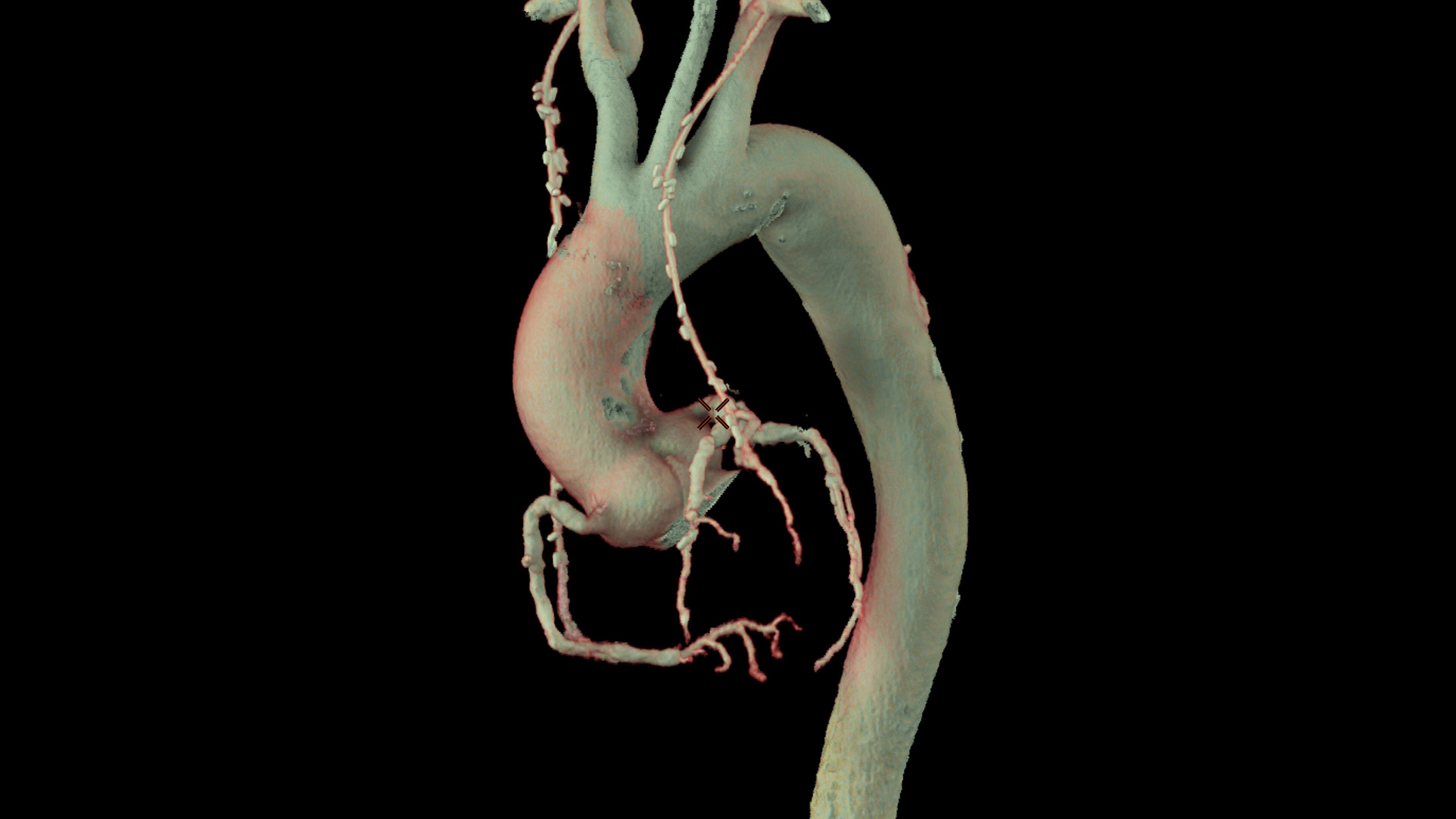 Product Media Carousel Image