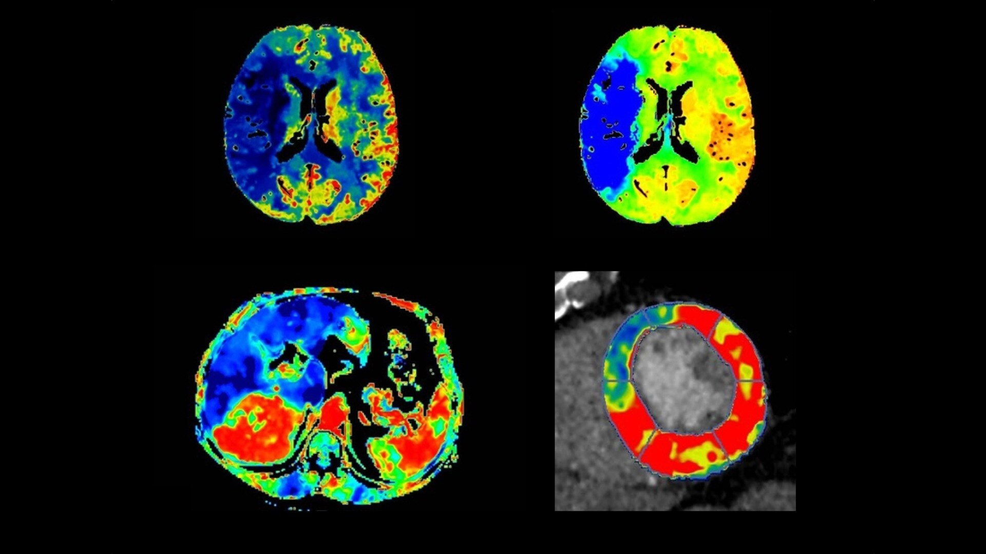 Product Media Carousel Image