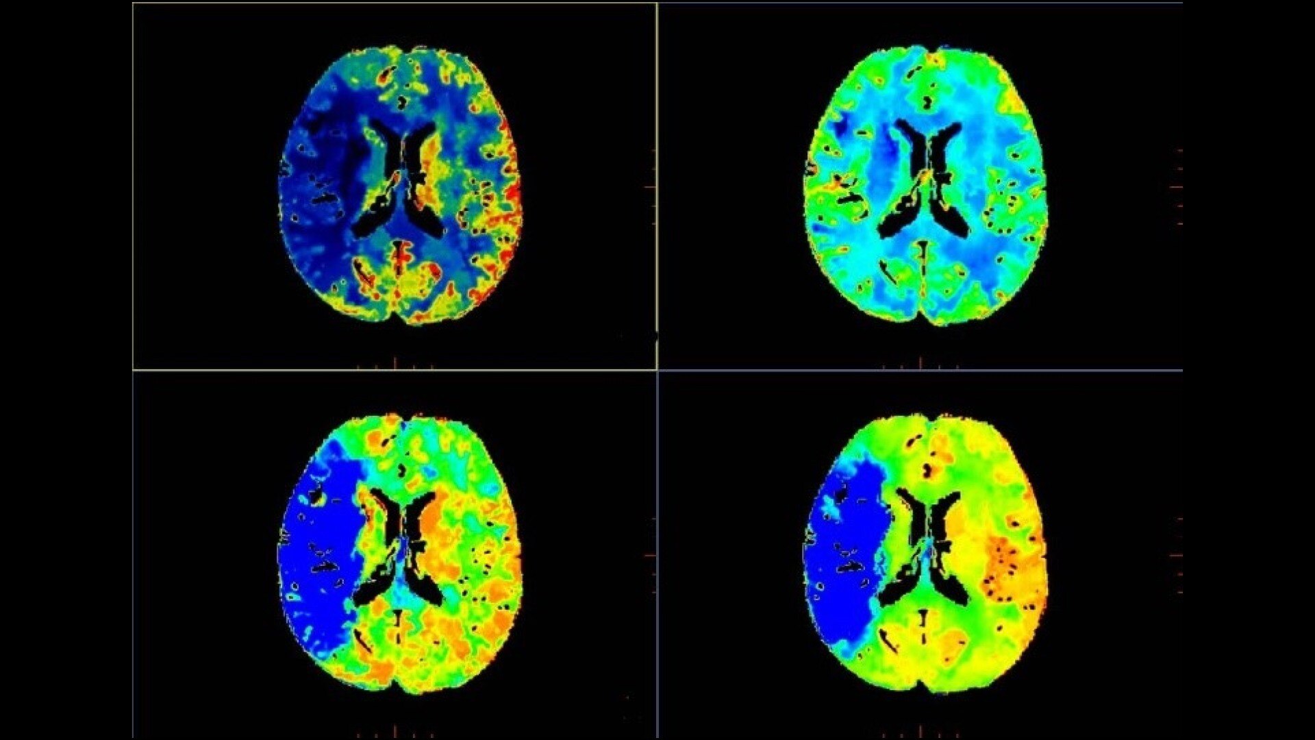 Product Media Carousel Image