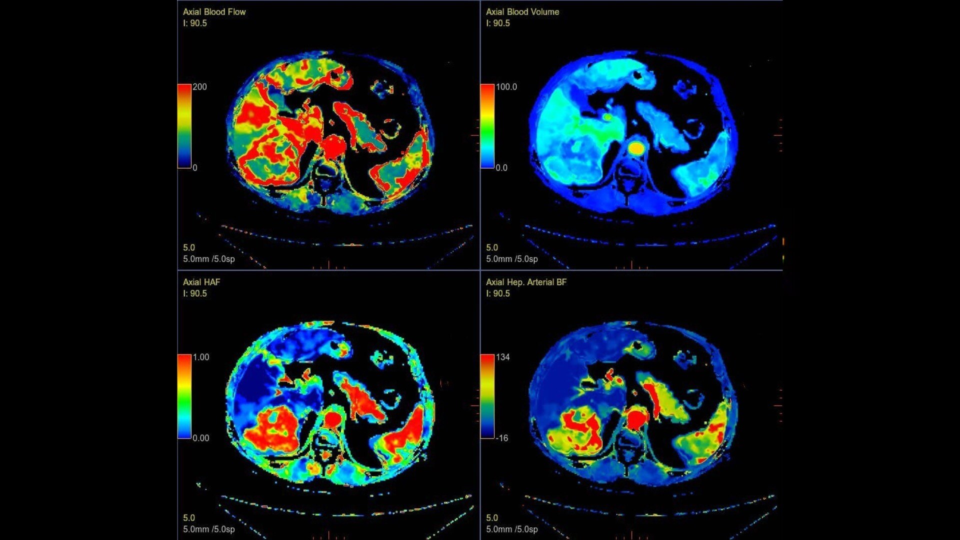 Product Media Carousel Image