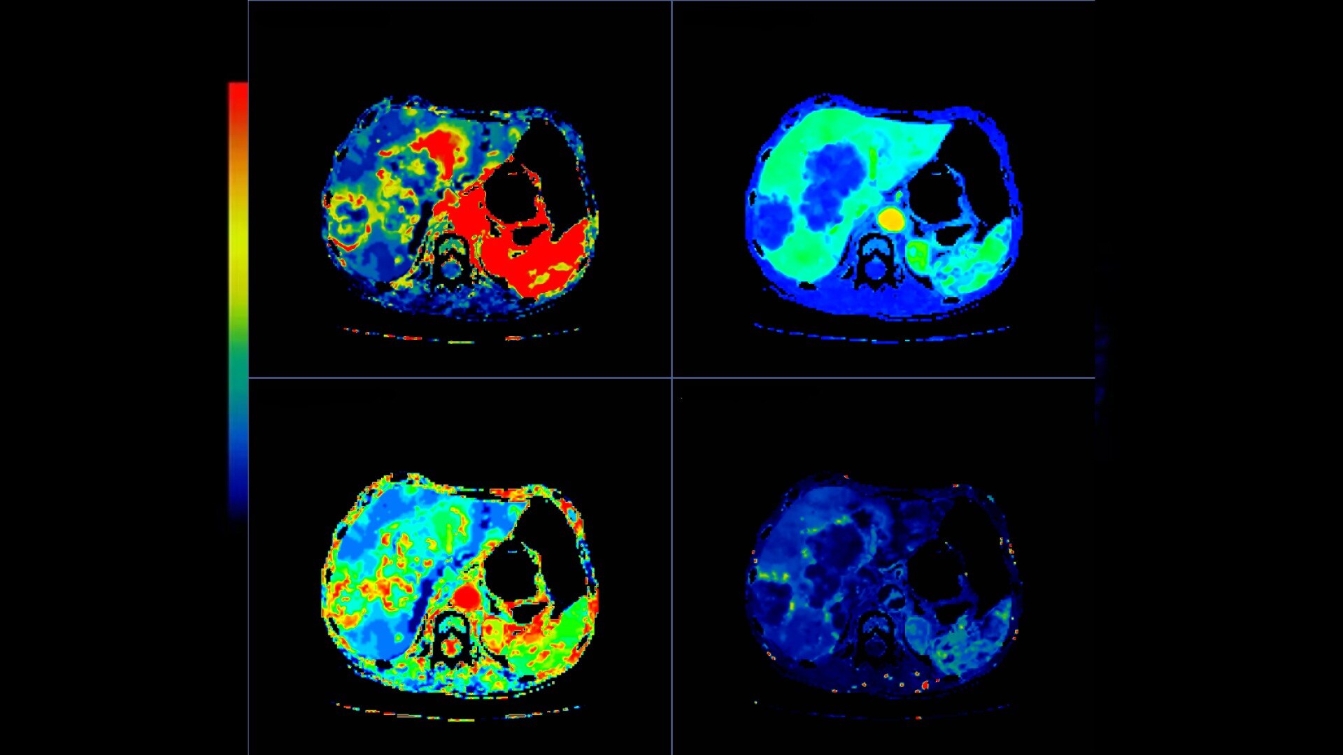 Product Media Carousel Image