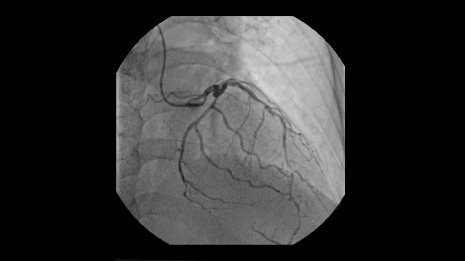 Product Media Carousel Image