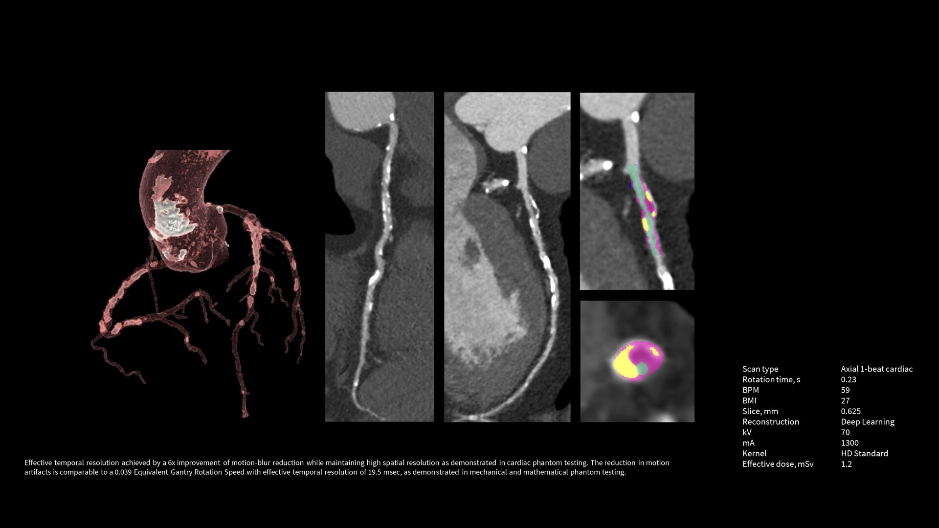 Product Media Carousel Image