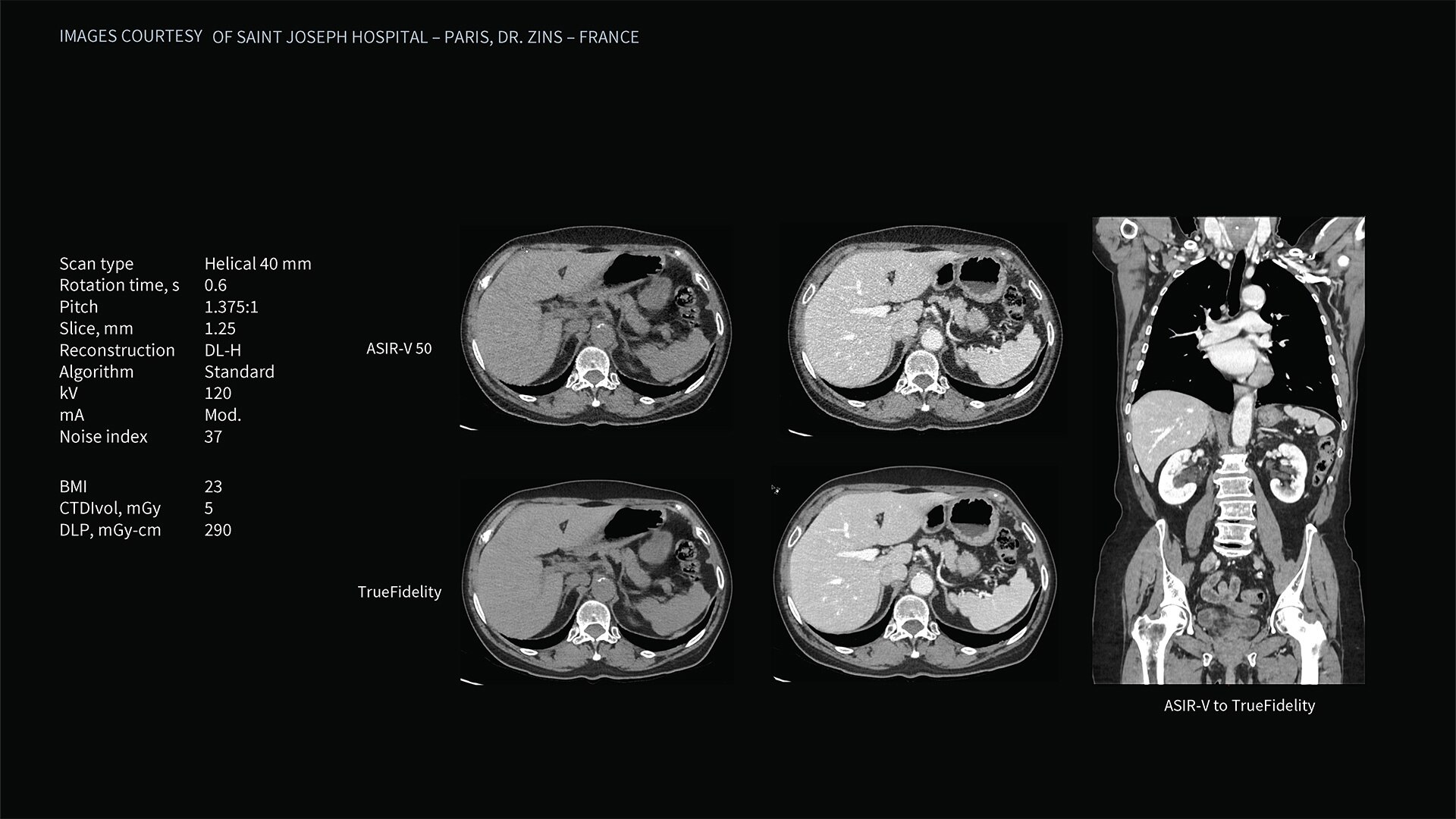 Product Media Carousel Image