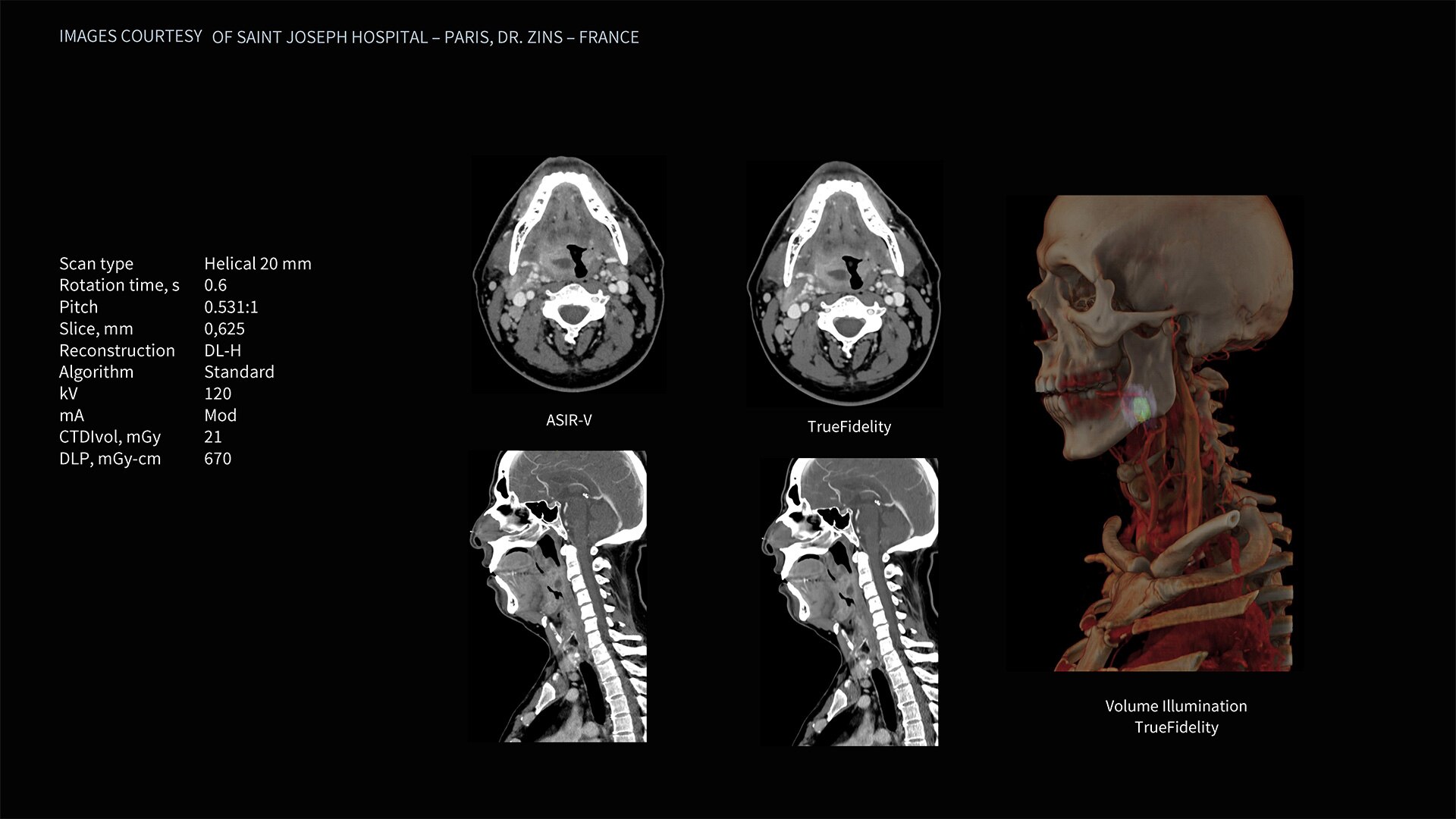 Product Media Carousel Image